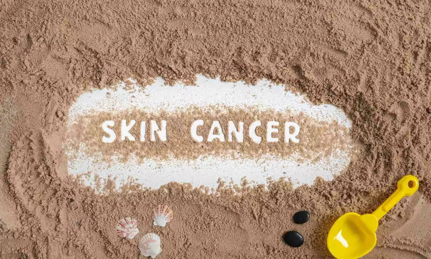 New imaging tech promises to help doctors better diagnose and treat skin cancers: Study
