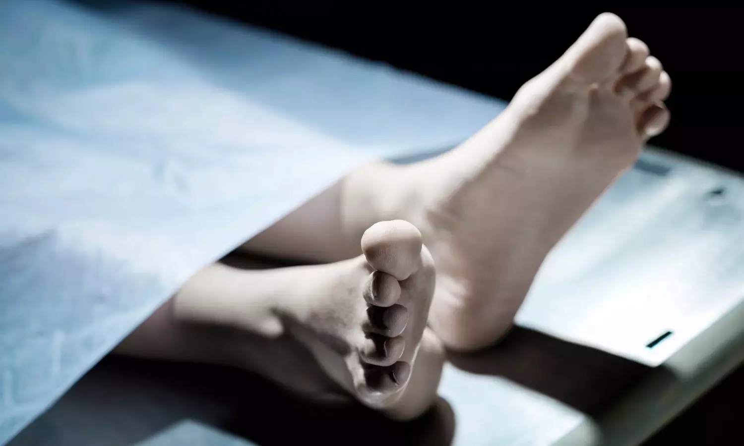 RG Kar doctor dies under mysterious circumstances, family alleges work pressure