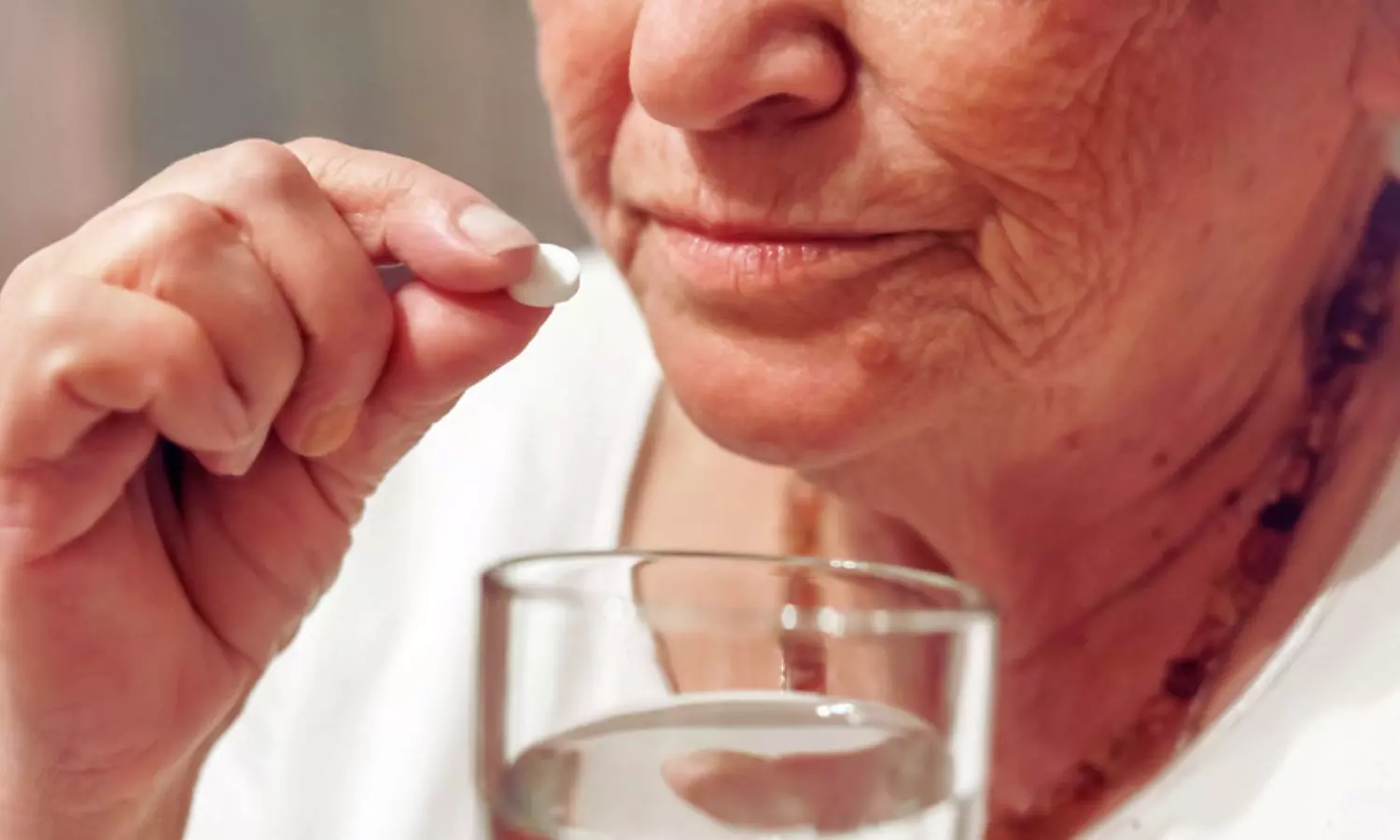 Switching Frail Older AF Patients to DOACs Reduces Stroke and Fatal Bleeding, Study Finds
