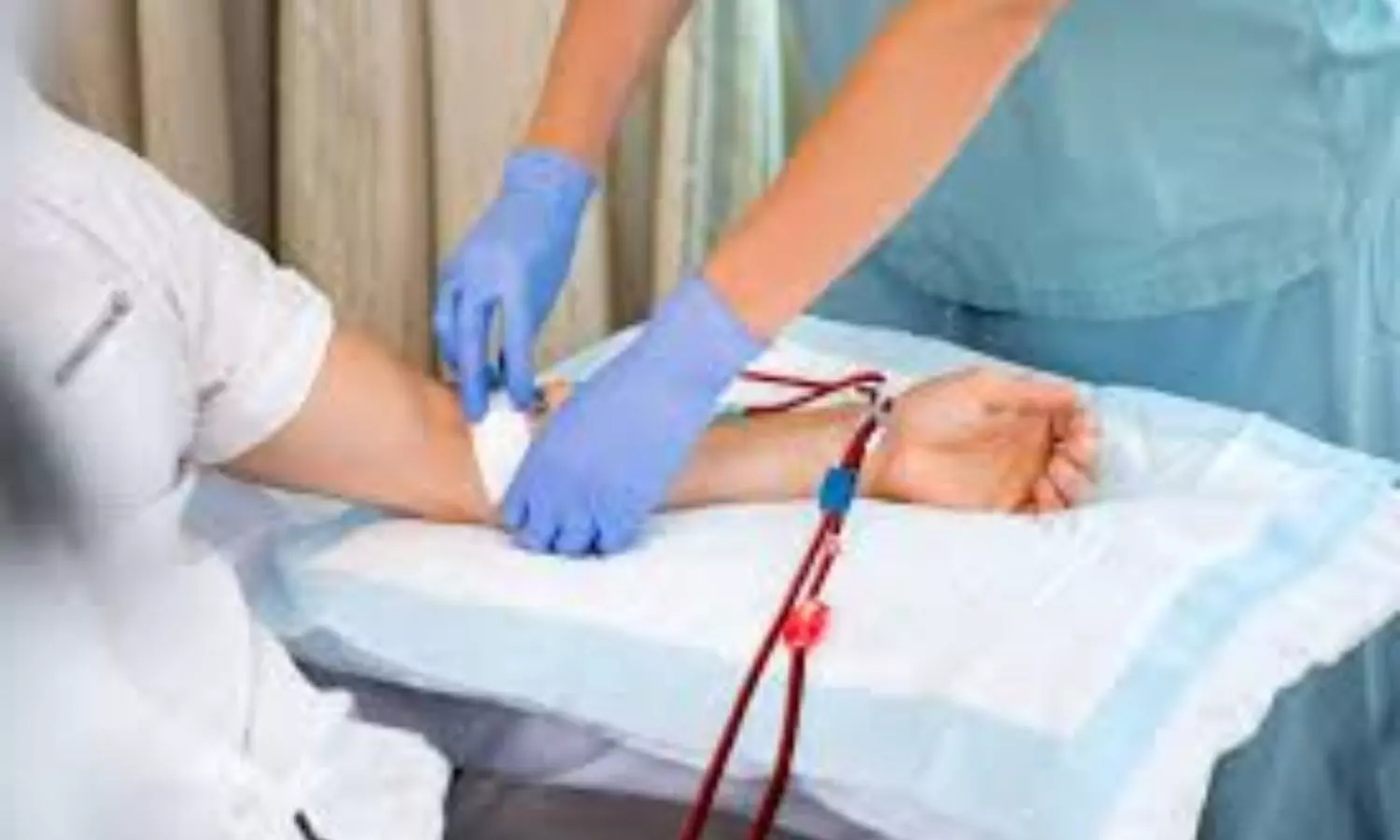 IV Iron Therapy Valuable Despite No Link with h-cTnT in Hemodialysis Patients: Study