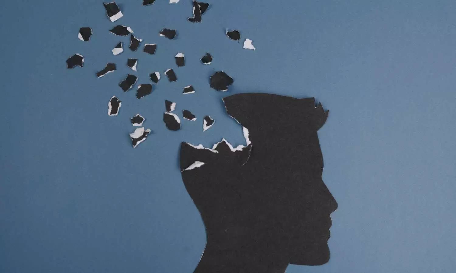 No Link Found Between Transient Ischemic Attack and Long-Term Dementia Risk: Study