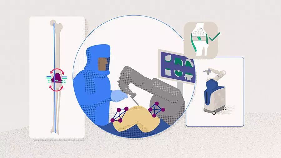 RA-TKA offers superior short-term outcomes over conventional techniques, but long-term benefits uncertain: study