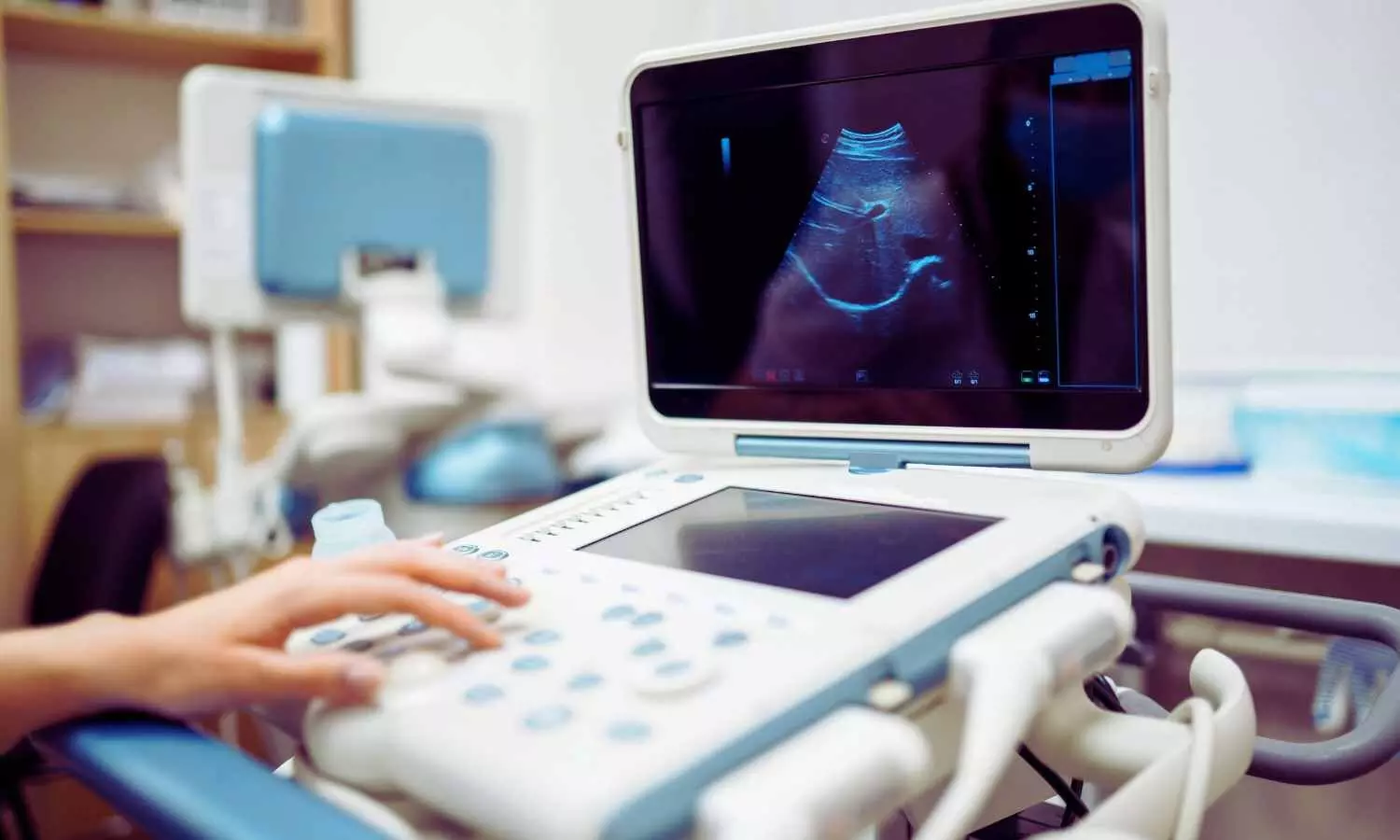 First impressions count: How babies are talked about during ultrasounds impacts parent perceptions, caregiving relationship