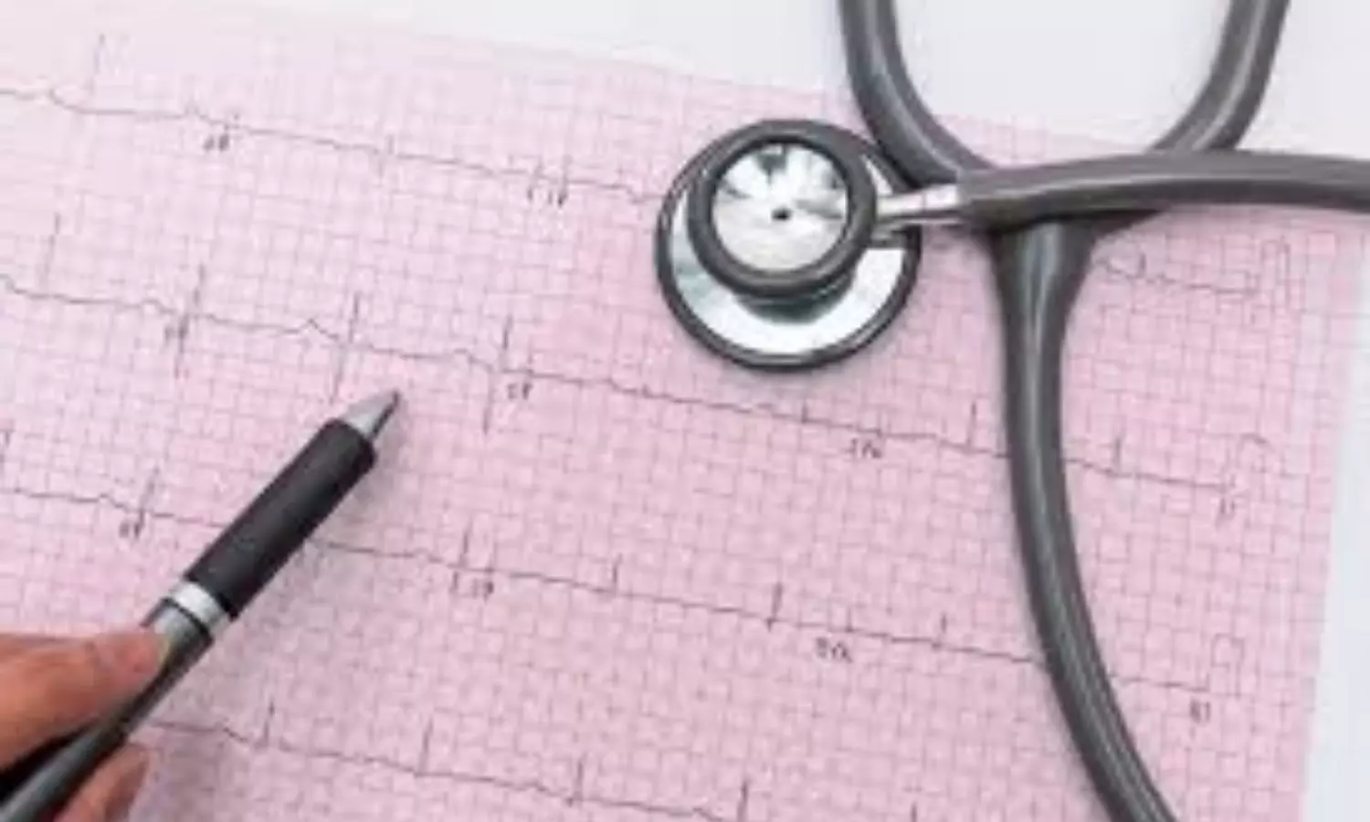 Acoustic Cardiography with ECG may predict Preeclampsia, reveals study