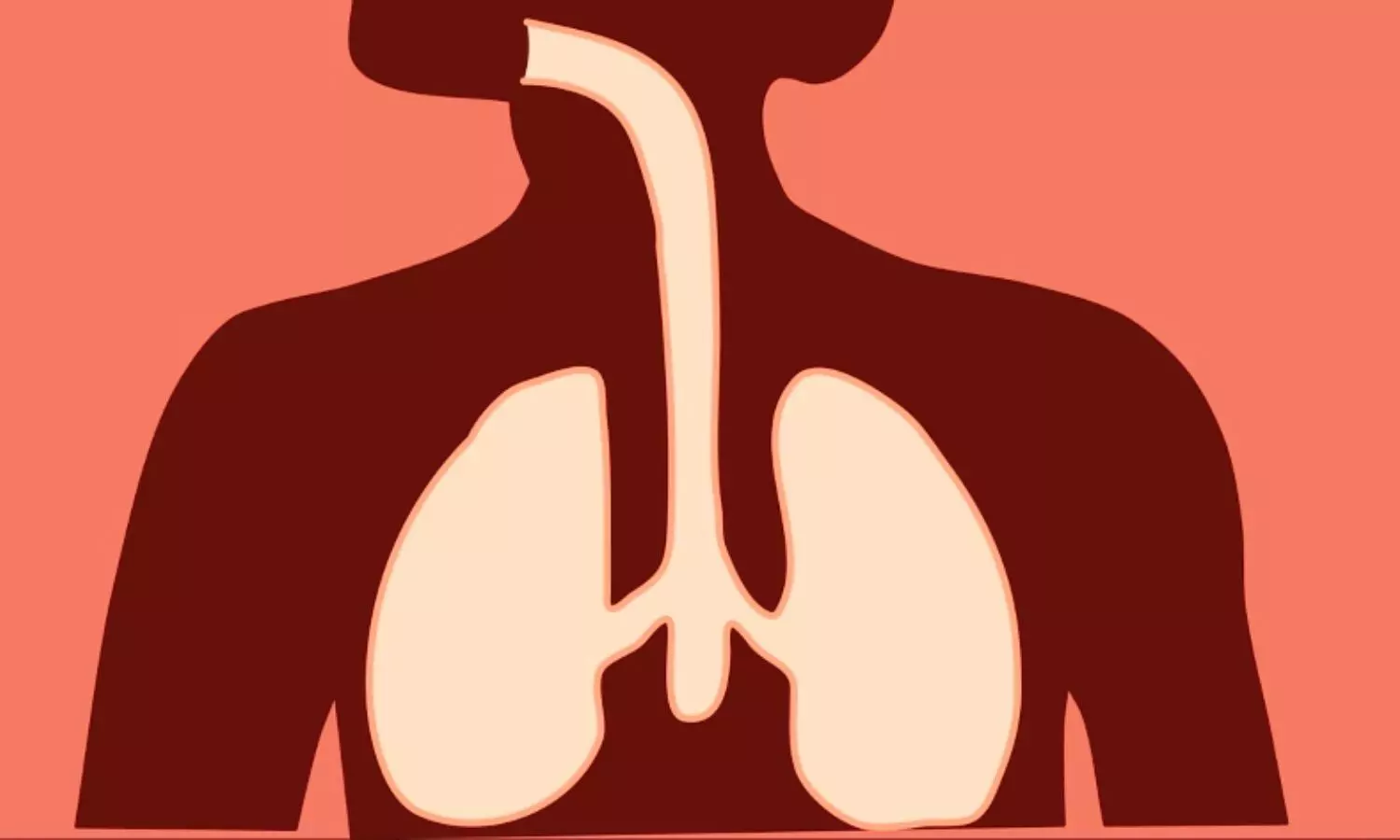 Sotatercept Improves Early Pulmonary Arterial Hypertension Outcomes: NEJM
