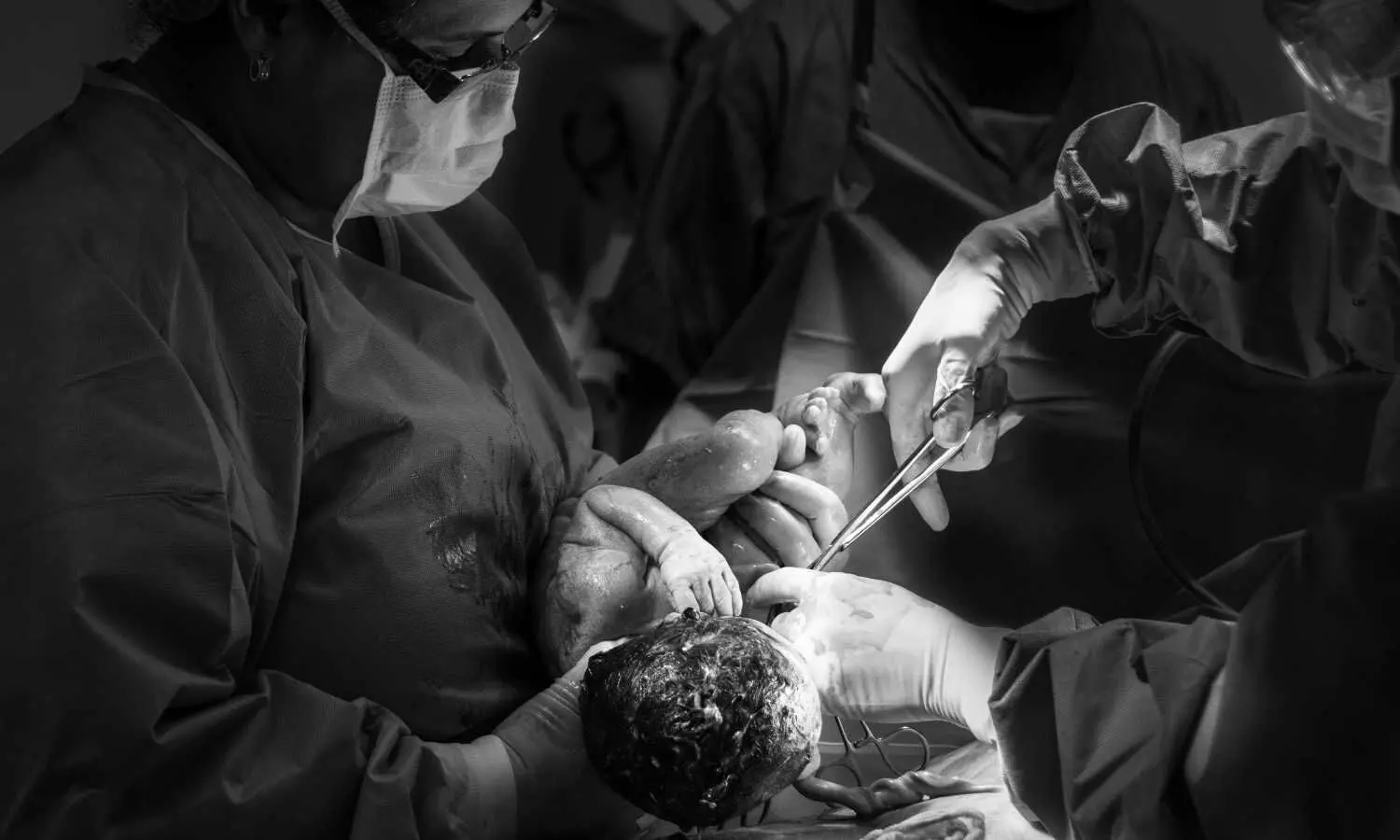 Researchers find surgical technique reduced risk of early preterm birth for patients with cervical insufficiency