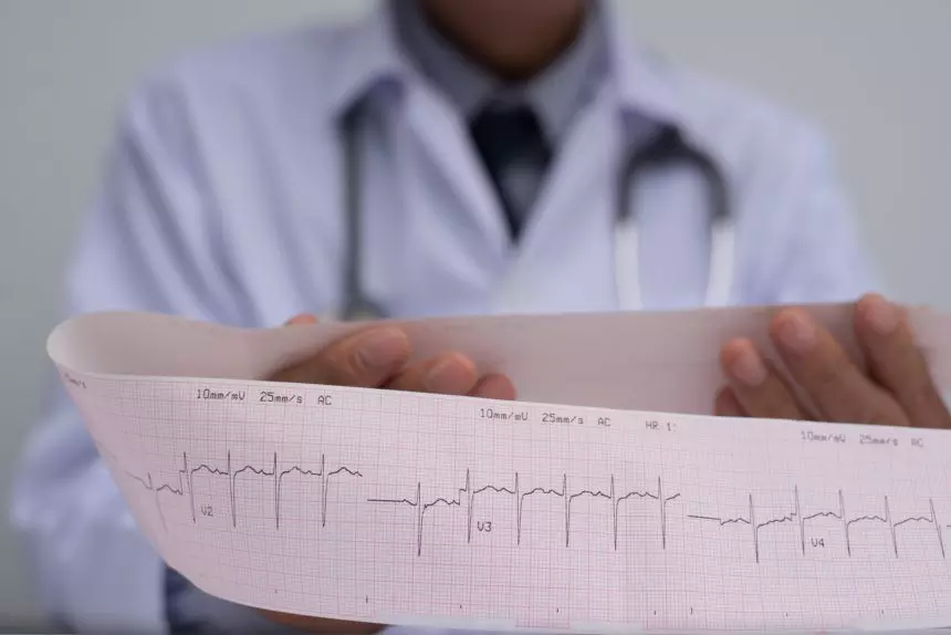 Deep learning model helps in identifying the risk of complete heart block, finds JAMA
