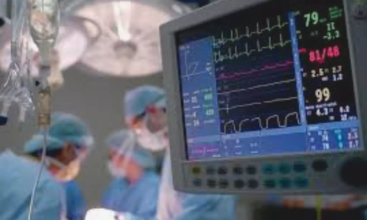 FFR-Guided Complete Revascularization Beneficial in NSTEMI With Multivessel Disease: JAMA