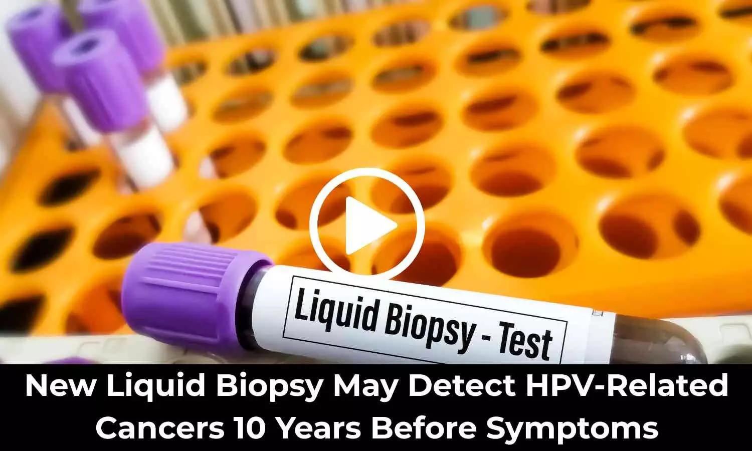 New Liquid Biopsy May Detect HPV-Related Cancers 10 Years Before Symptoms: Study Finds