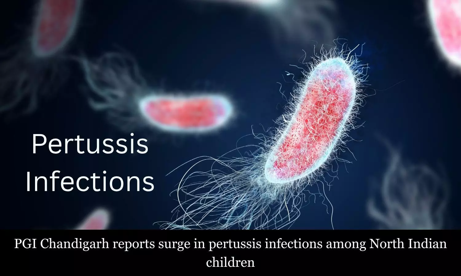 PGI Chandigarh flags surge in pertussis-like infections in North India