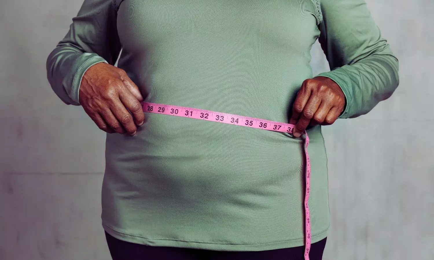 Delivery Dilemmas: Study evaluating Obesity's Influence on Cesarean Section Trends