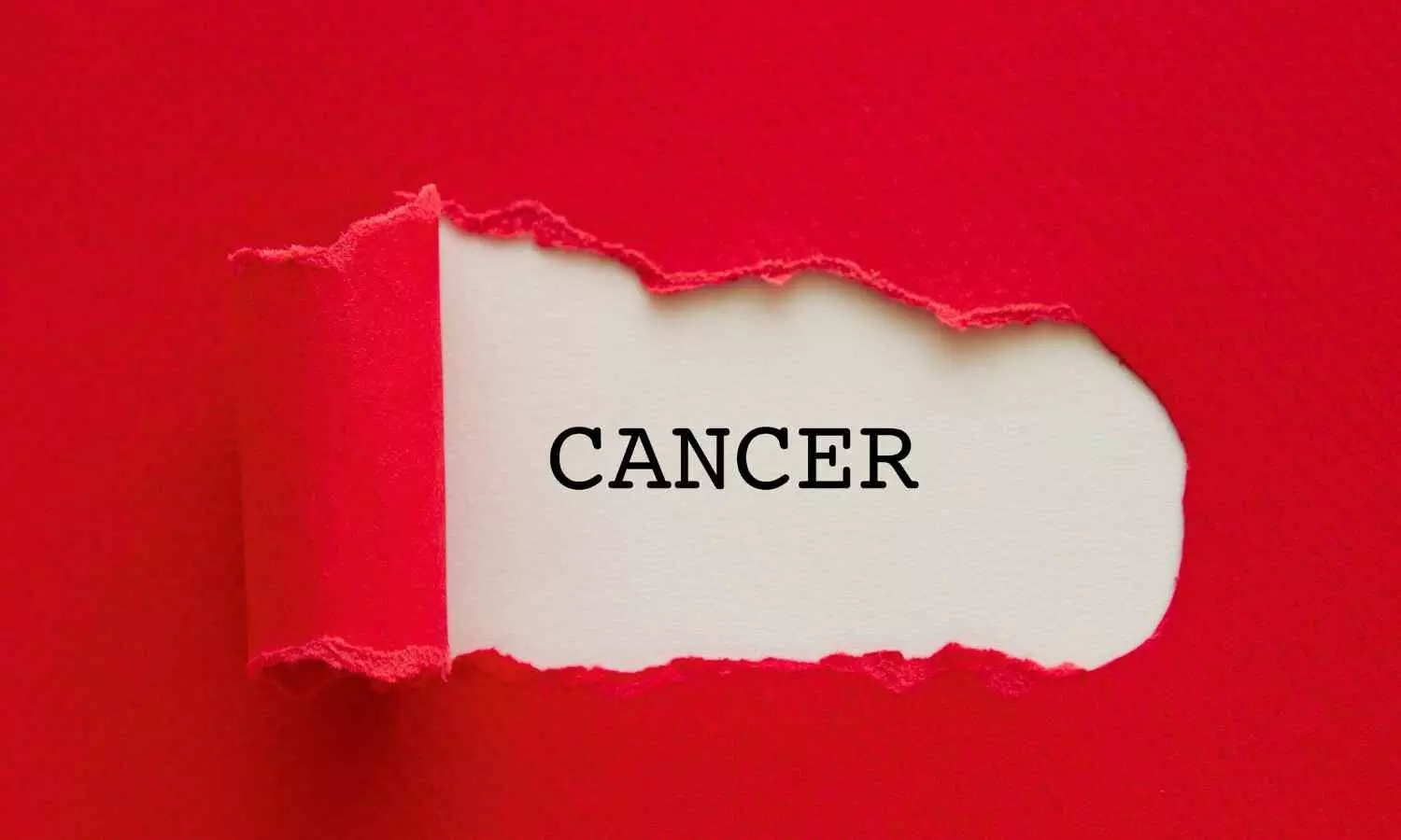 High protein or Trp diet increases risk of cancer-associated VTE: Study