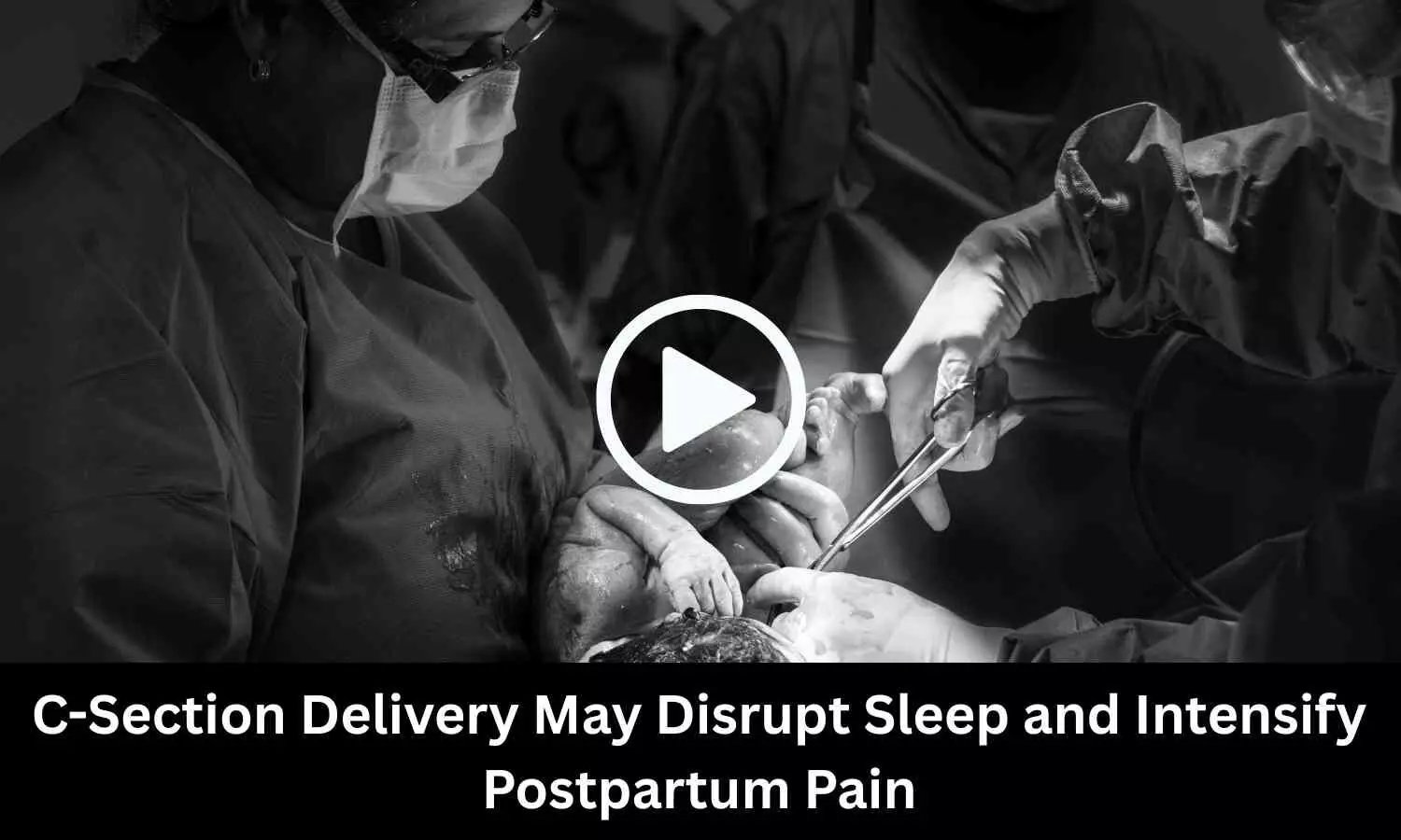 C-Section Delivery May Disrupt Sleep and Intensify Postpartum Pain: Study Finds