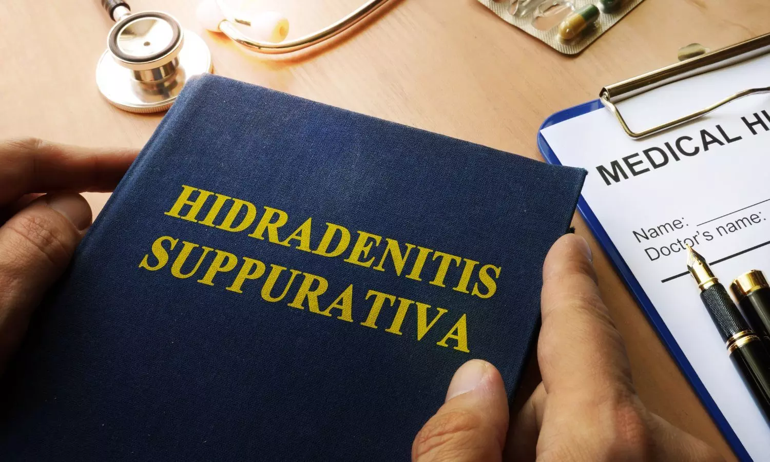 Hidradenitis Suppurativa Linked to Higher Risk of Serious Eye Diseases: Study