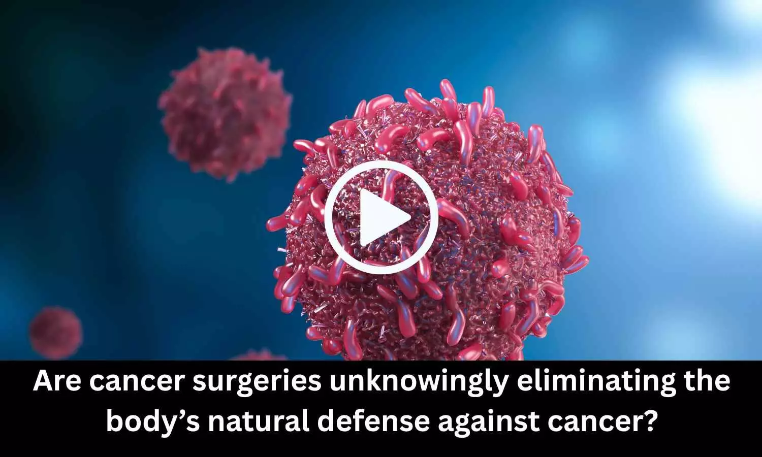 Are cancer surgeries unknowingly eliminating the body's natural defense against cancer? Study sheds light