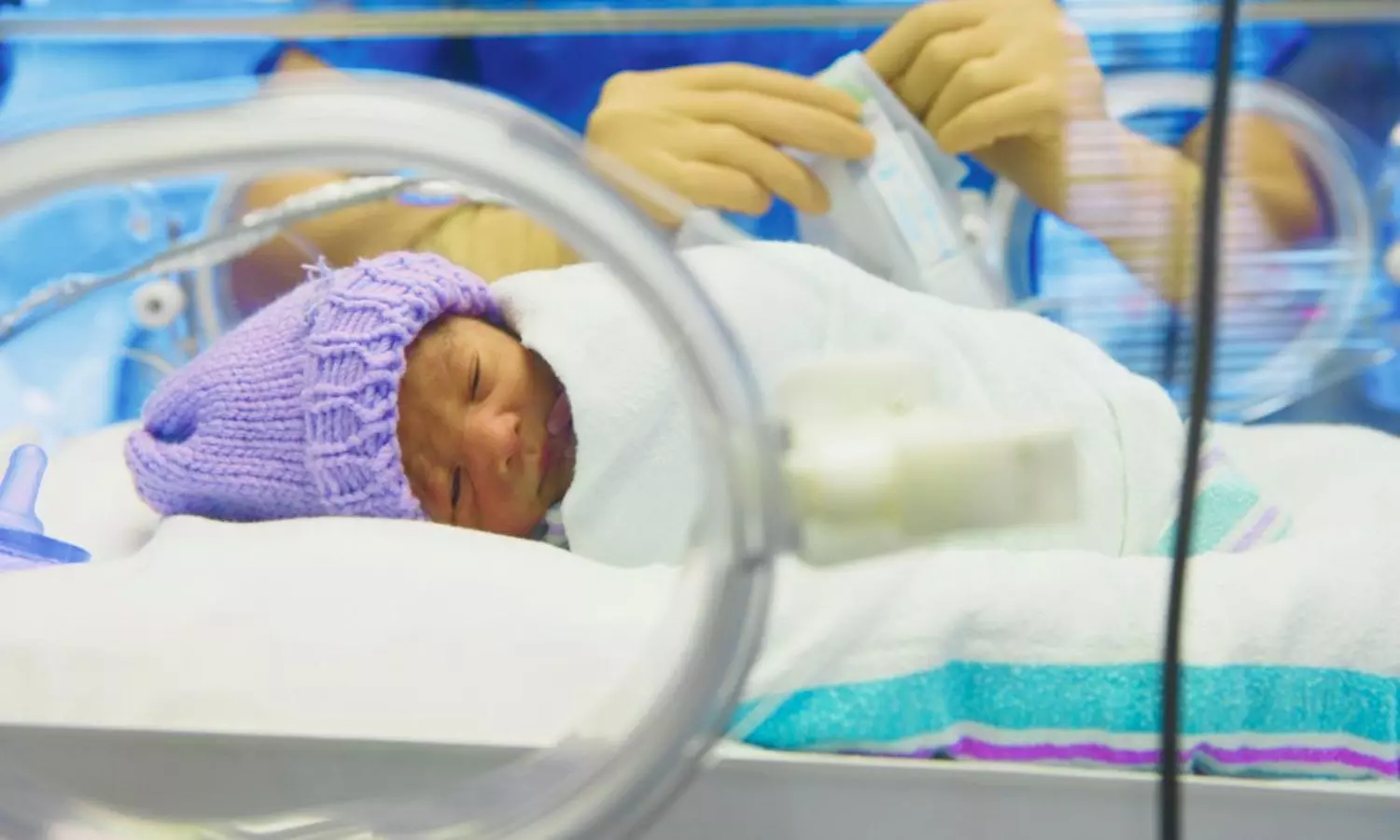 Dynamic Model Predicts Individualized Benefits and Risks of Platelet Transfusion in Preterm Infants with Thrombocytopenia: JAMA