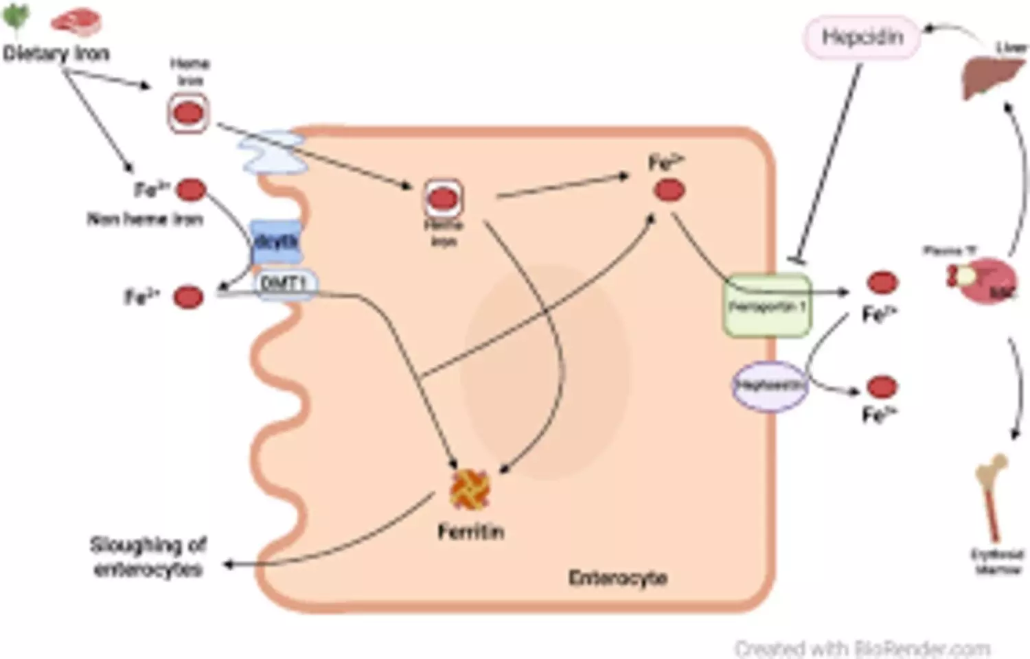 Could Serum Ferritin Be Simple Prognostic Tool in Cirrhosis?