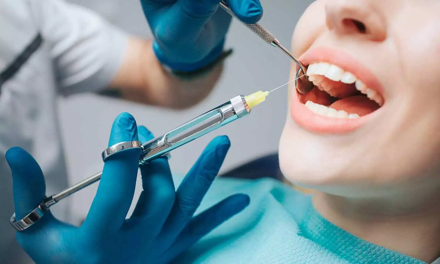 Intralesional PRP Therapy Shows Promise for Mild to Moderate OSMF: Study