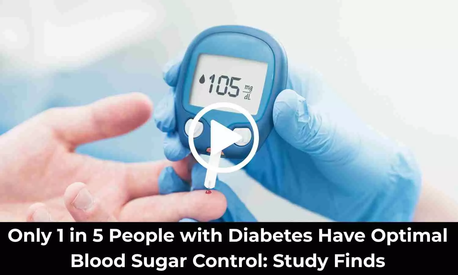 Only 1 in 5 People with Diabetes Have Optimal Blood Sugar Control: Study Finds