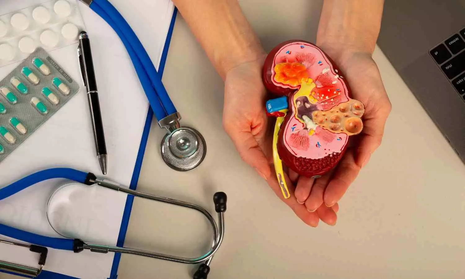 Greater Kidney Complications in Patients Diagnosed with Type 2 Diabetes Before 40: Study Finds