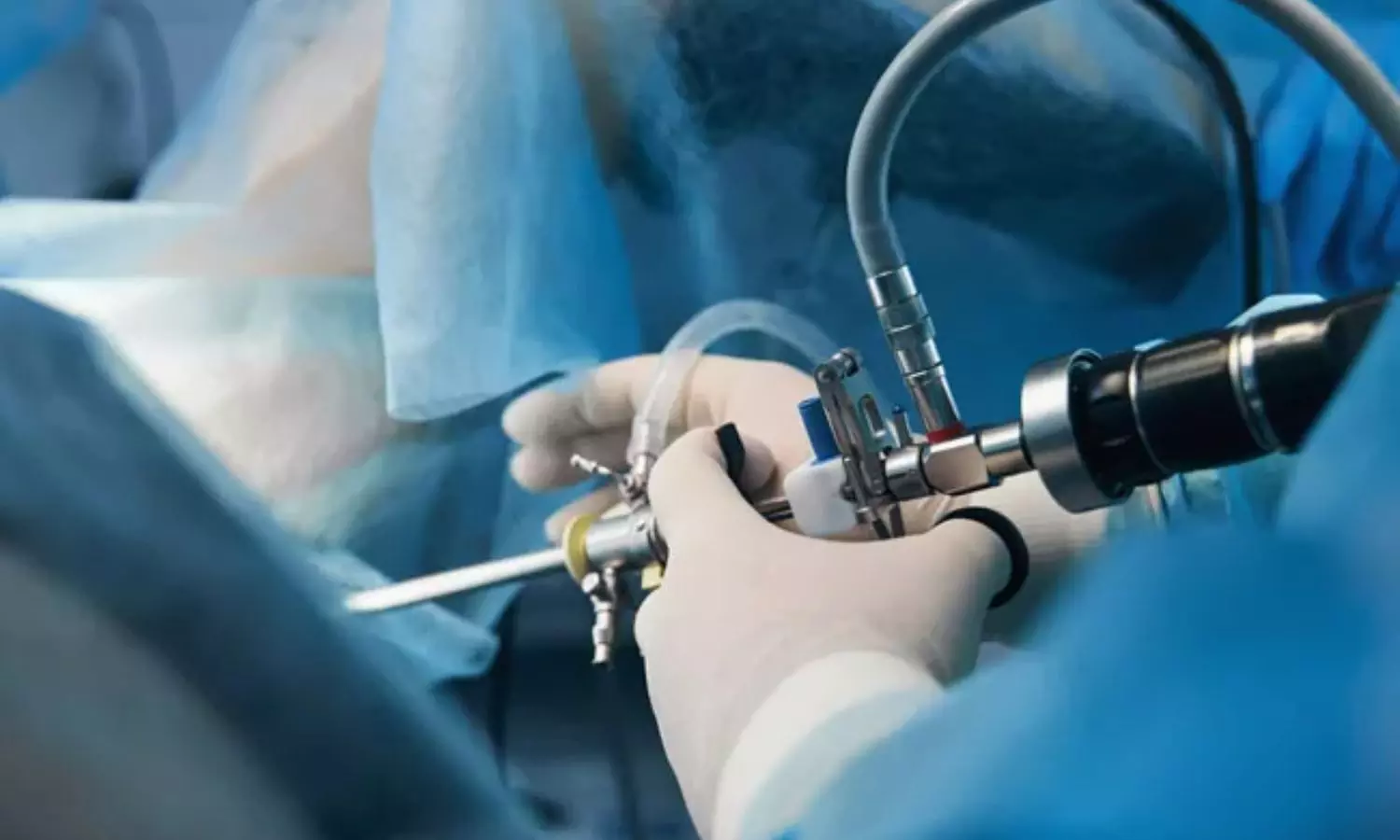 Hysteroscopic diagnostic criteria highly accurate and sensitive for detecting chronic endometritis: Study