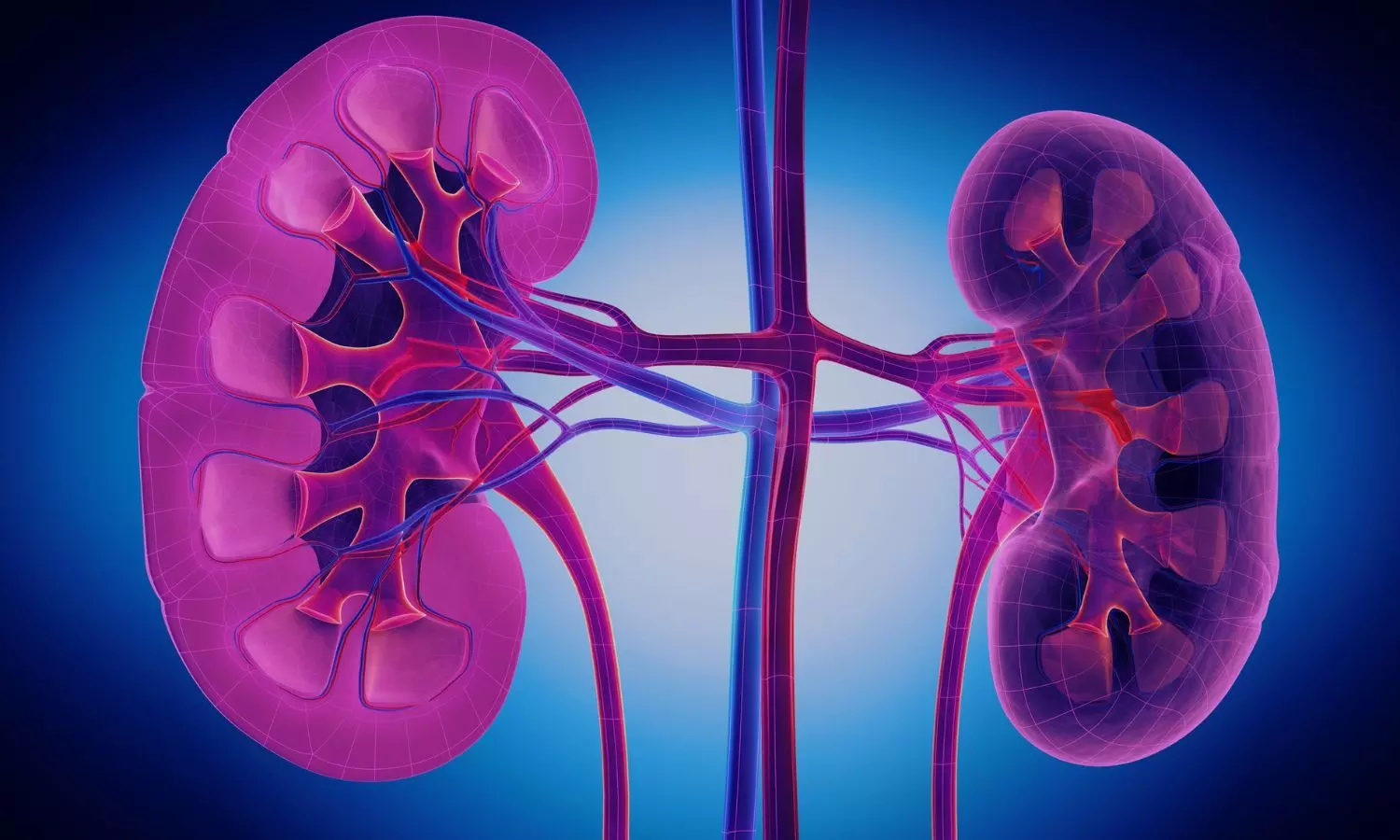 RCR Index Strong Predictor of Mortality and Disease Severity in Diabetic Nephropathy Patients: Study