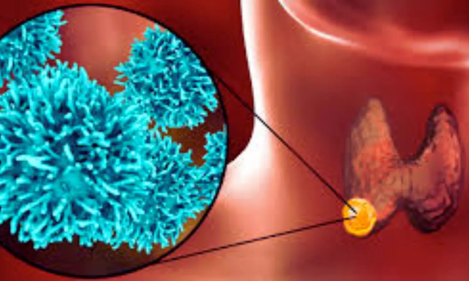 Possibilities for the early diagnosis of head and neck squamous cell carcinoma