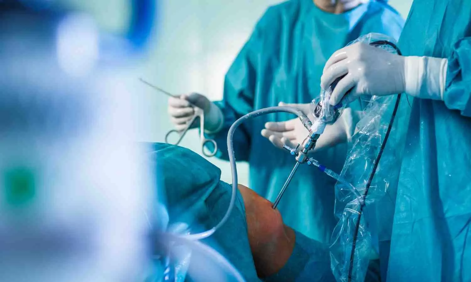 Bariatric Surgery Effective than Medical Management in Achieving Diabetes Remission: Study