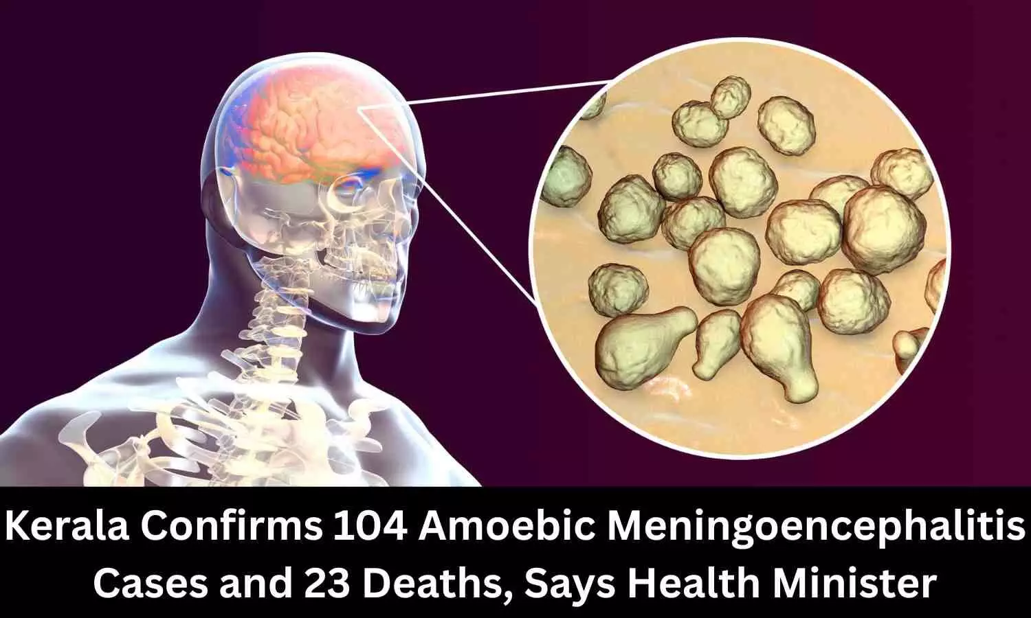 104 Amoebic Meningoencephalitis Cases and 23 Deaths, Says Kerala Health Minister