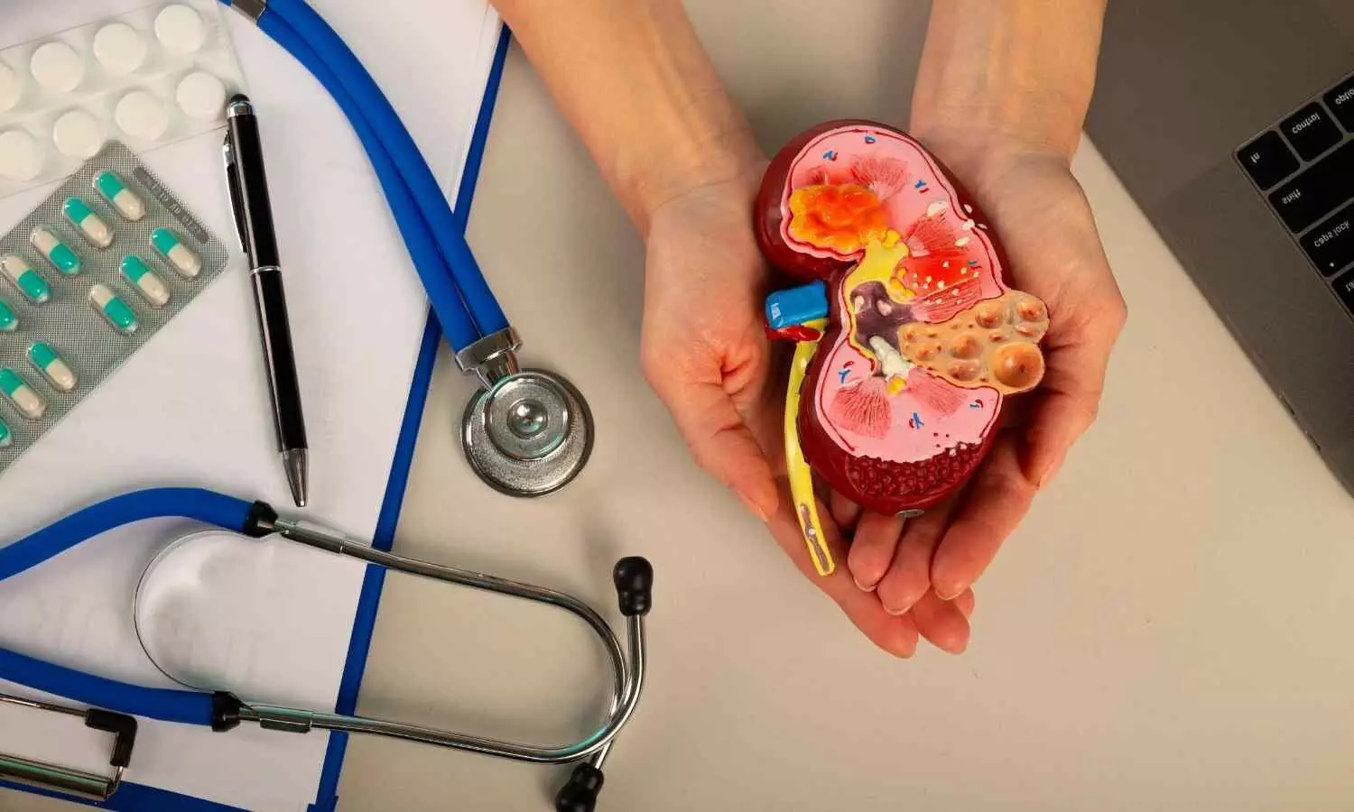 High Uric Acid at ICU Admission Signals Higher Risk of Kidney Complications and Mortality: Study