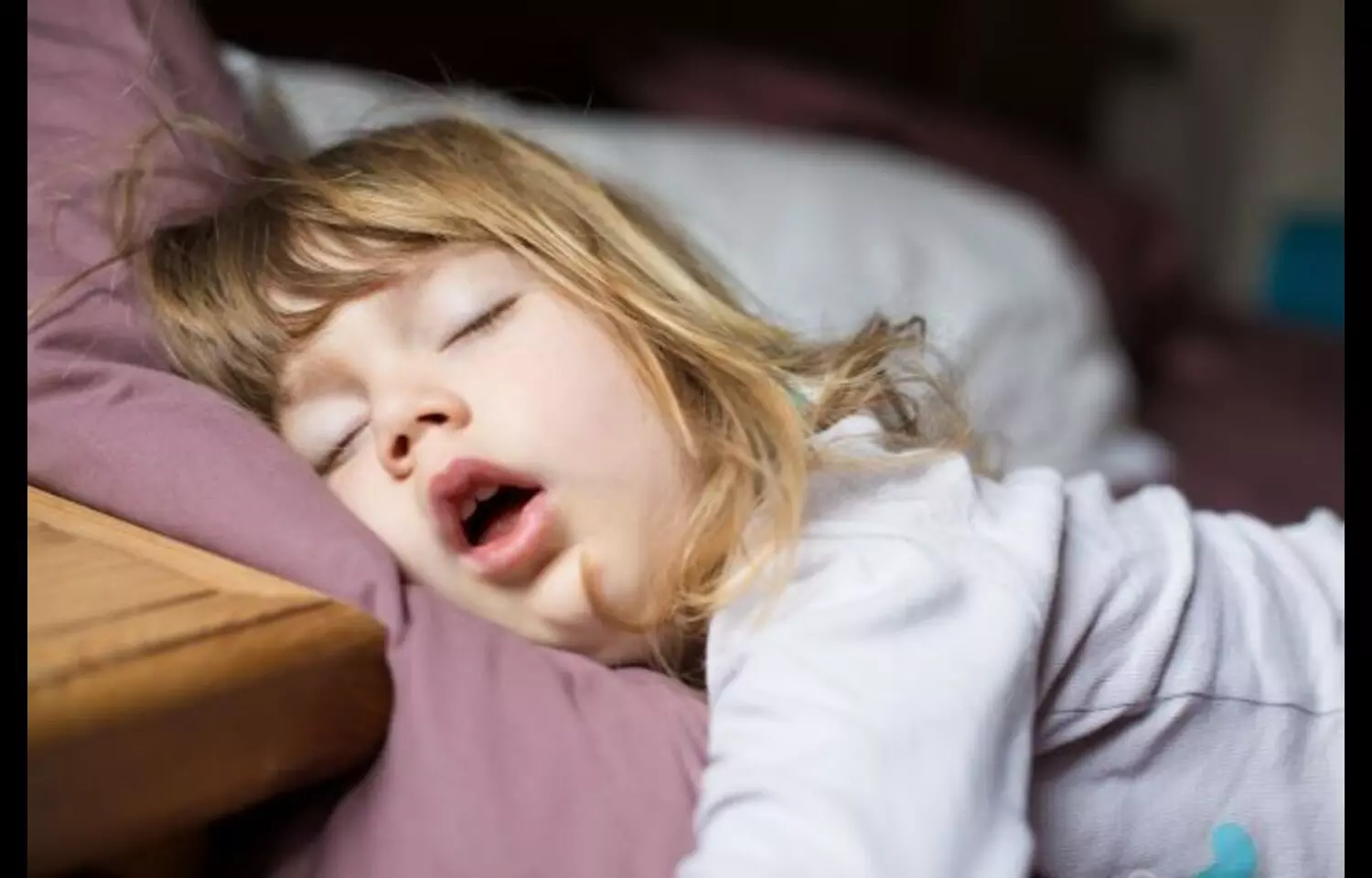 Mouth Breathing Linked to Sleep-Disordered Breathing in Children, finds study