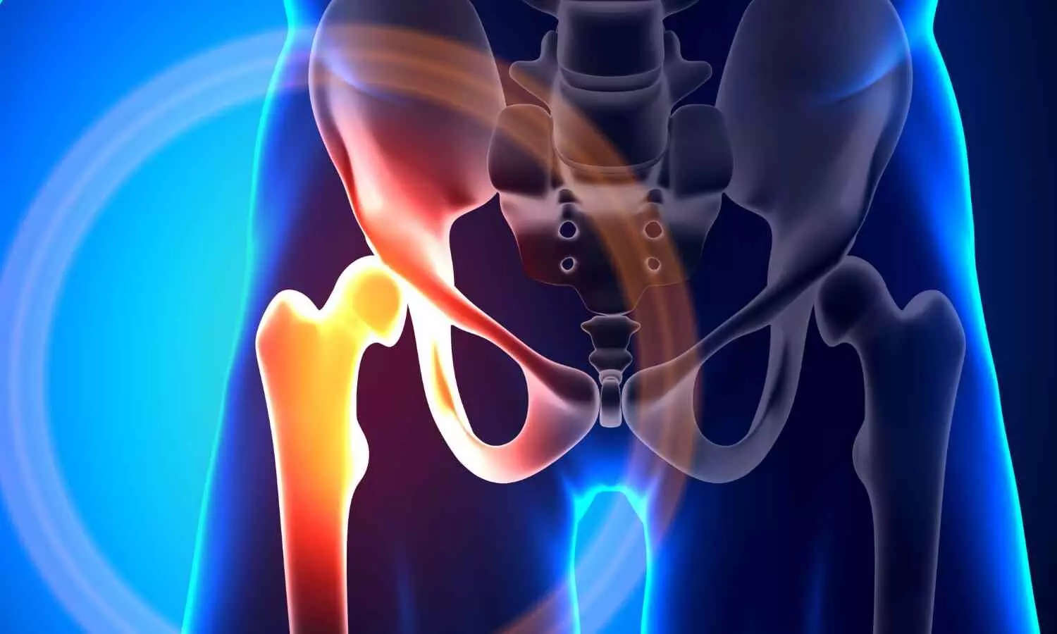 Anesthesiologist-Led Care Speeds Hip-Fracture Surgery and Reduces Complications: Study