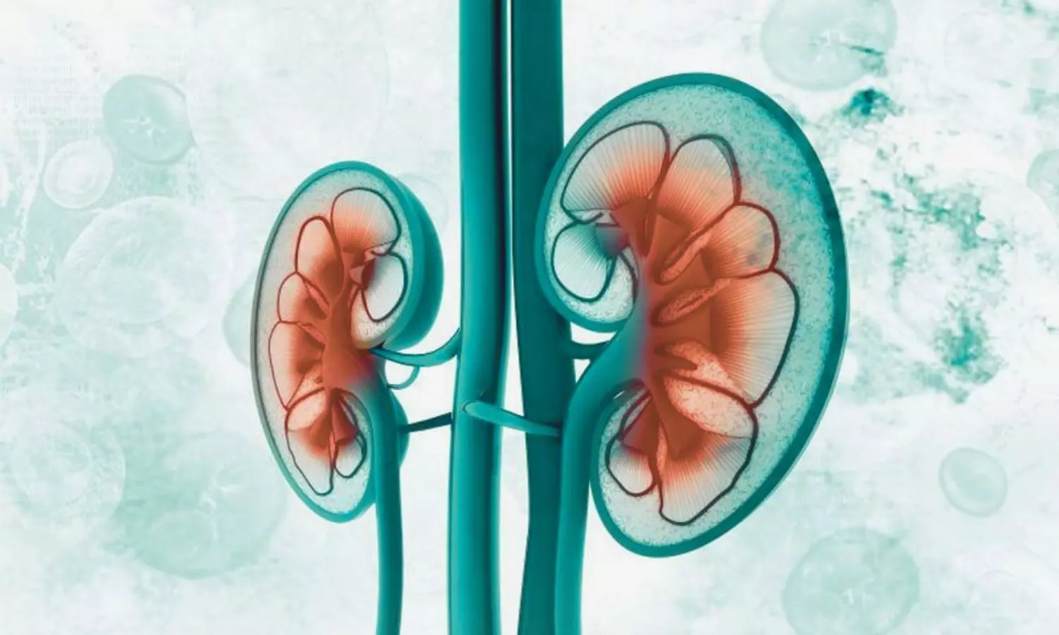 World's first clinical trial showing lubiprostone aids kidney function, finds study