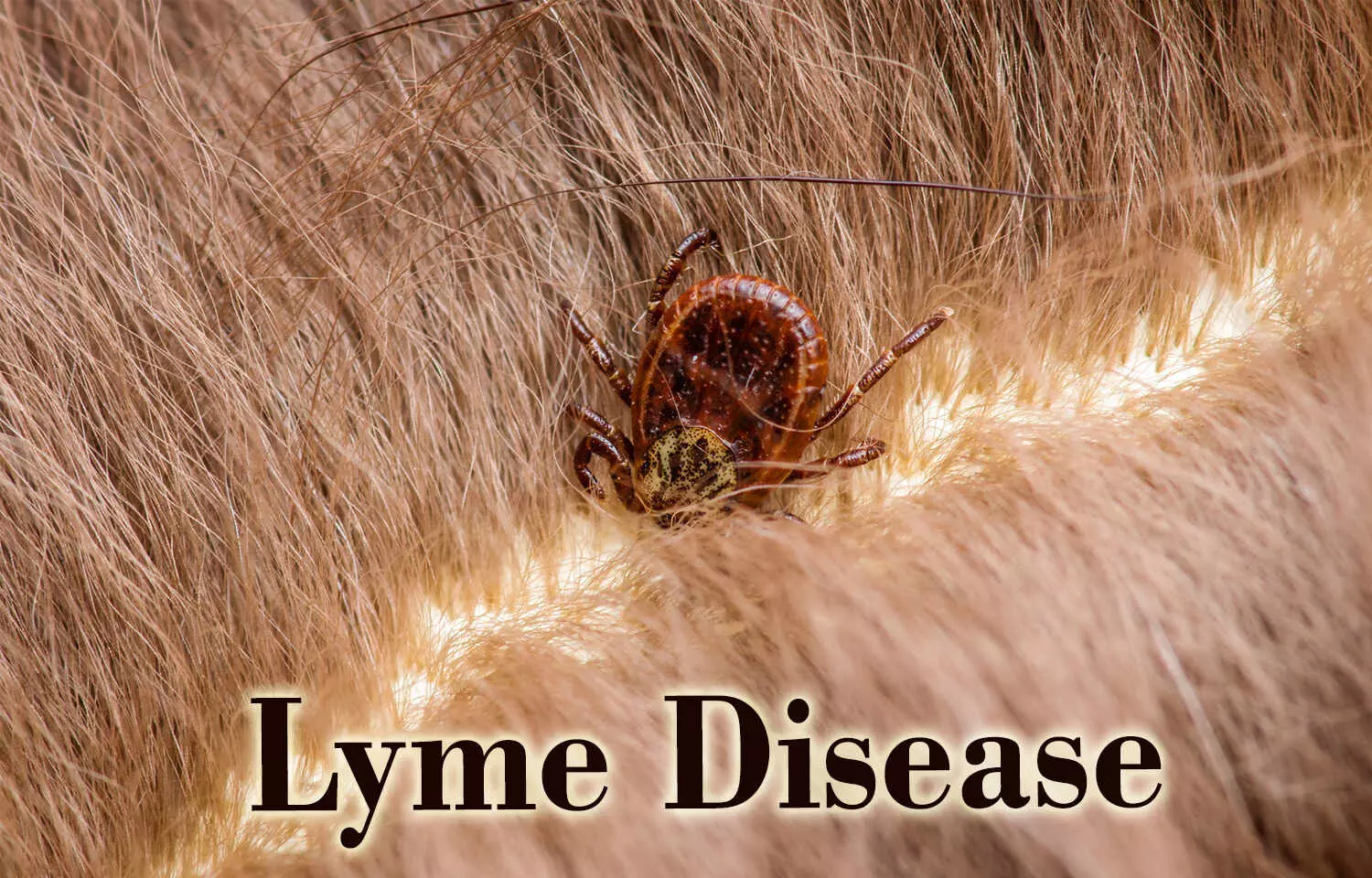 New test could allow for more accurate Lyme disease diagnosis