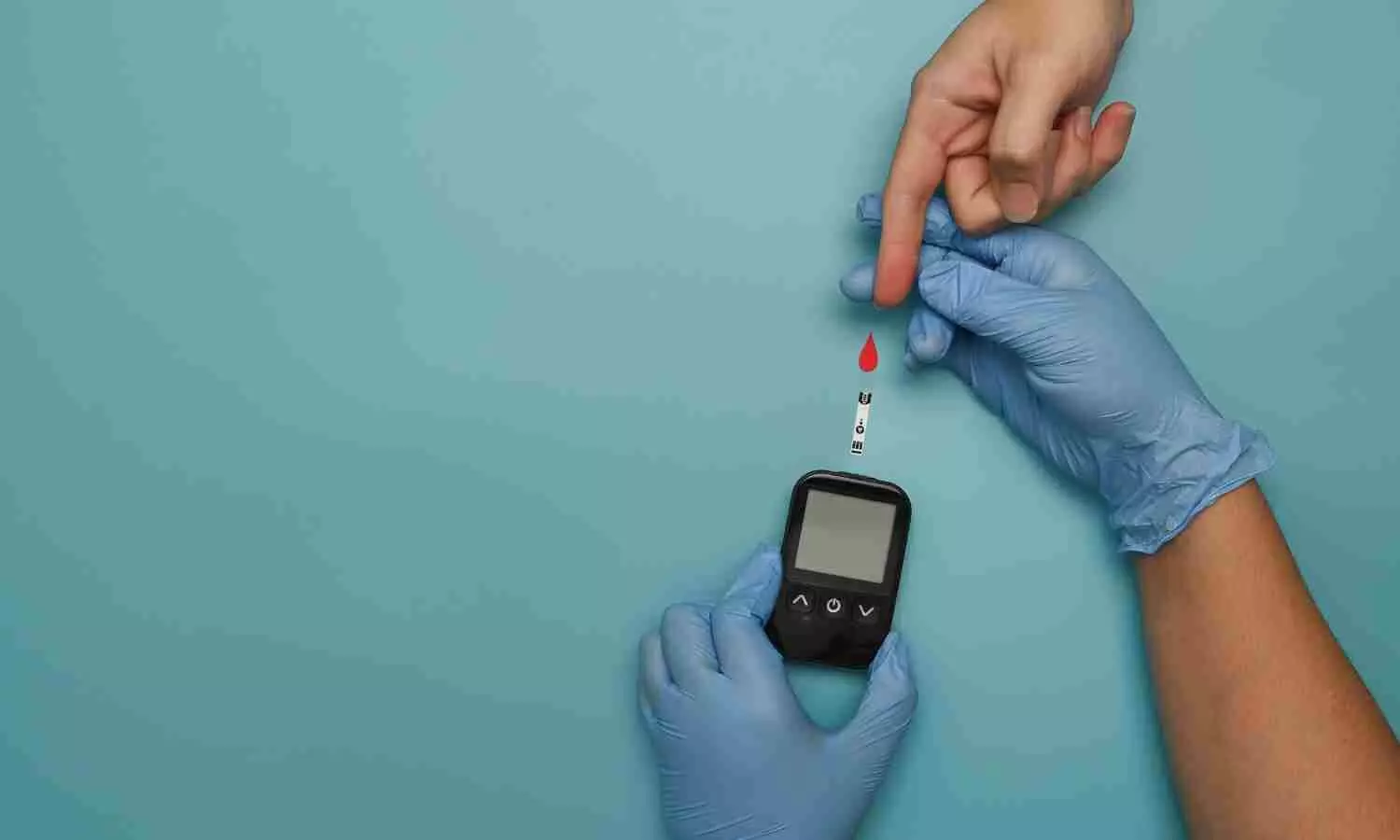 Sitagliptin Promotes DFU Healing Independent of Glucose Control: Study