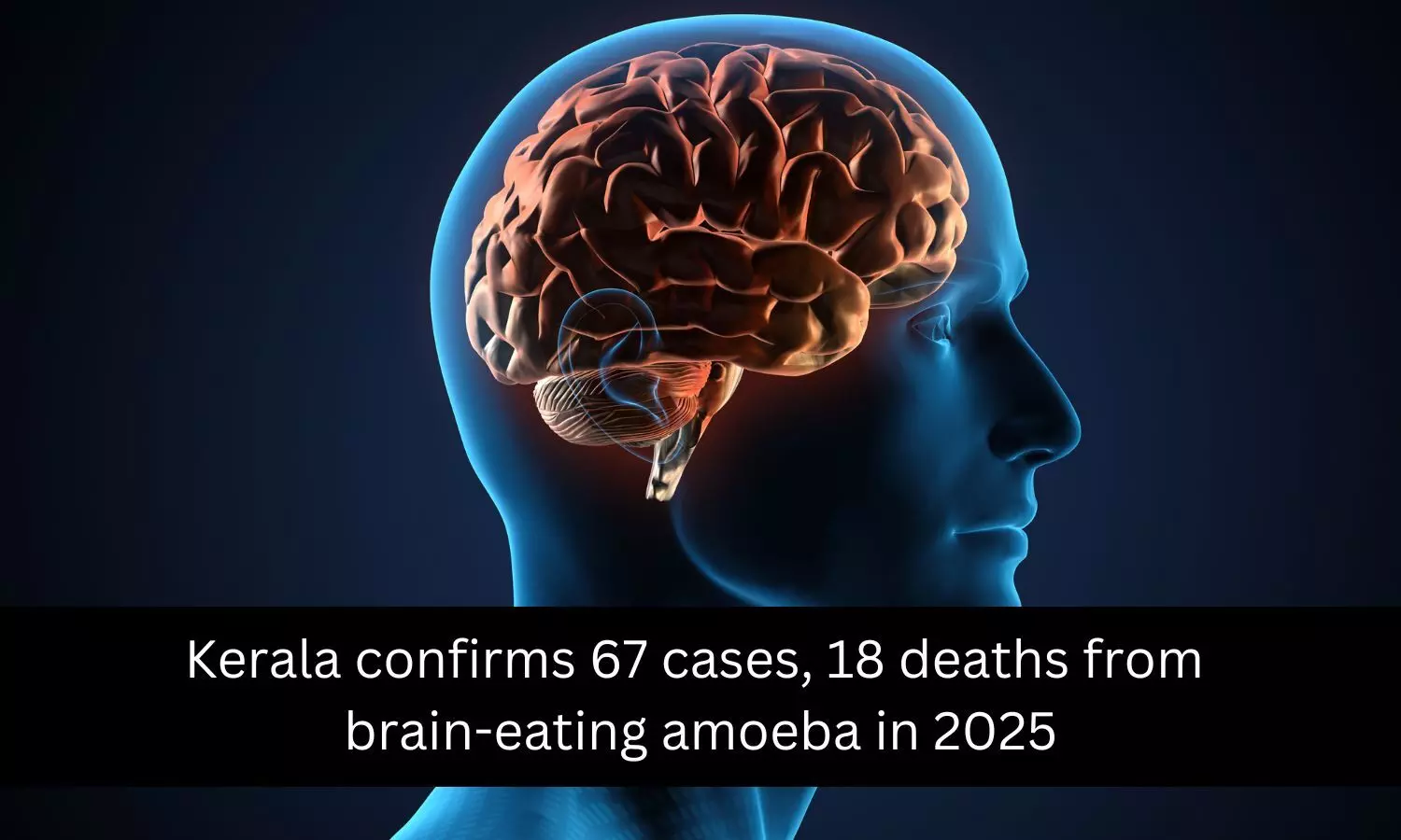 Kerala confirms 67 cases, 18 deaths from brain-eating amoeba in 2025