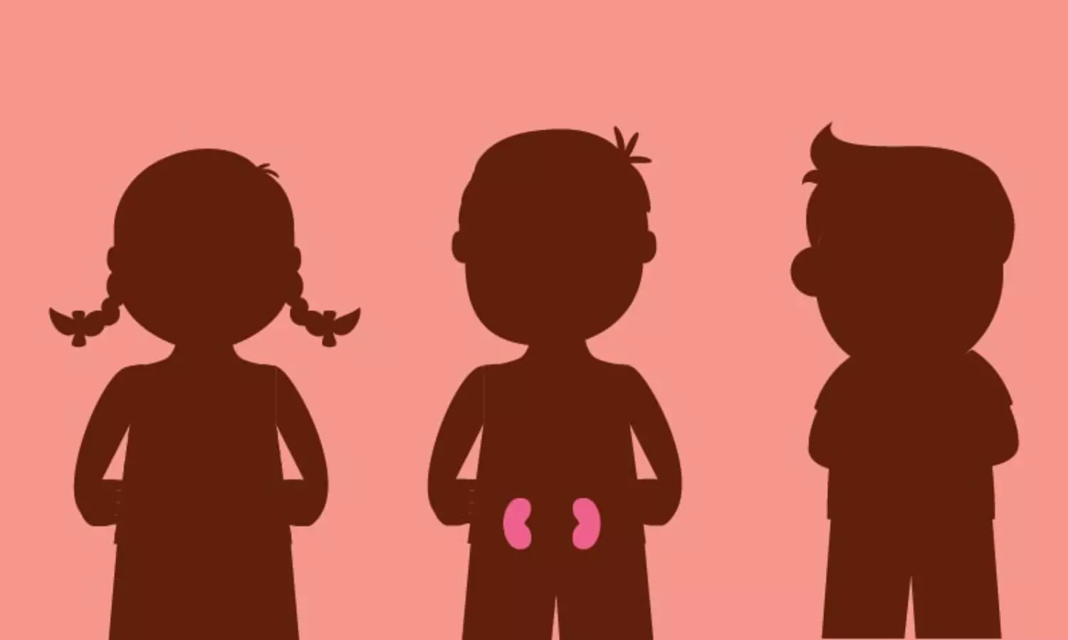Urinary NGAL useful Biomarker for differentiating SRNS vs SSNS, reports study