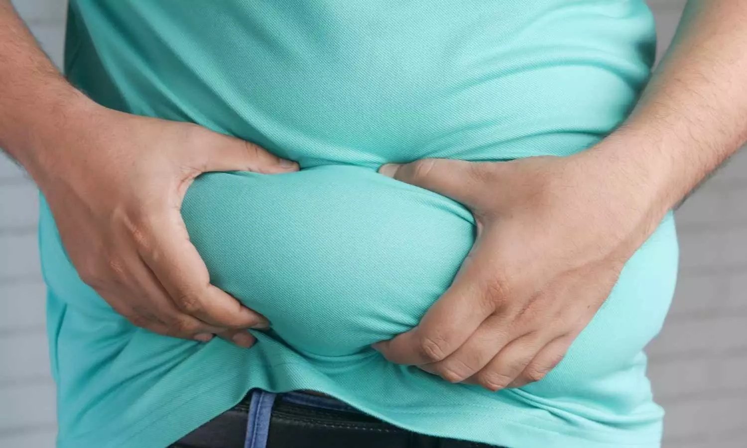 Central Obesity Linked to Higher Disease Severity in Psoriatic Arthritis: Study