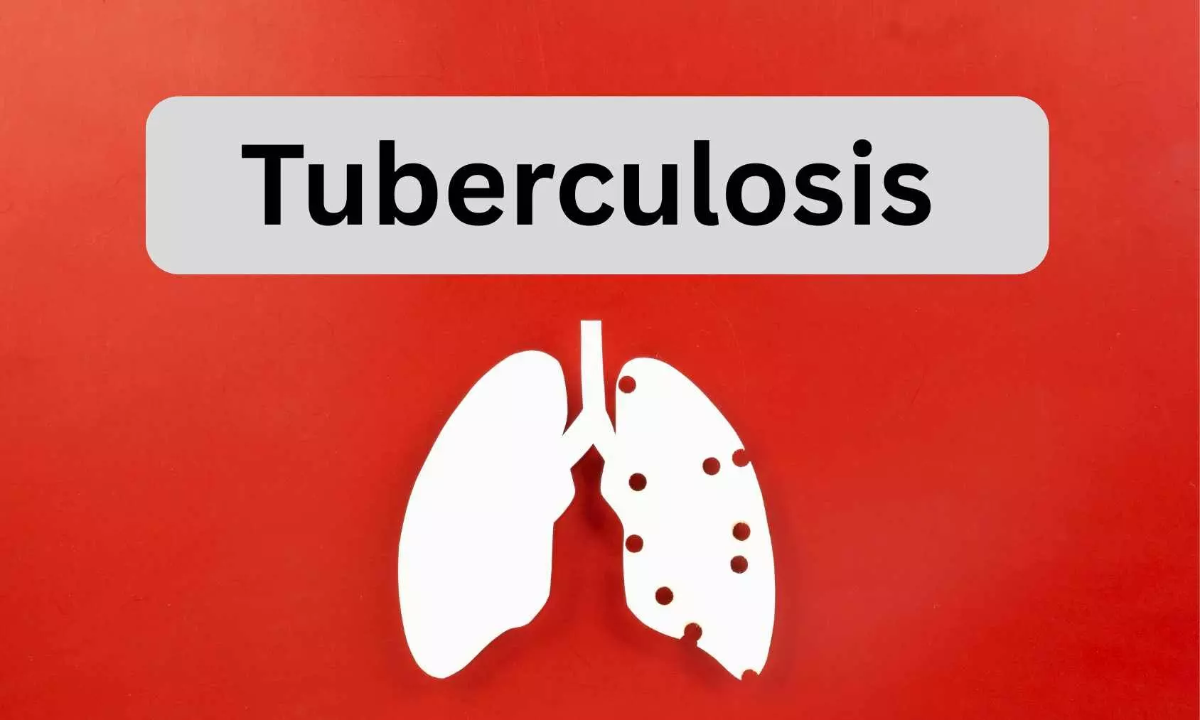 Low BMI Raises Risk of TB in IGRA-Positive Contacts, suggests research