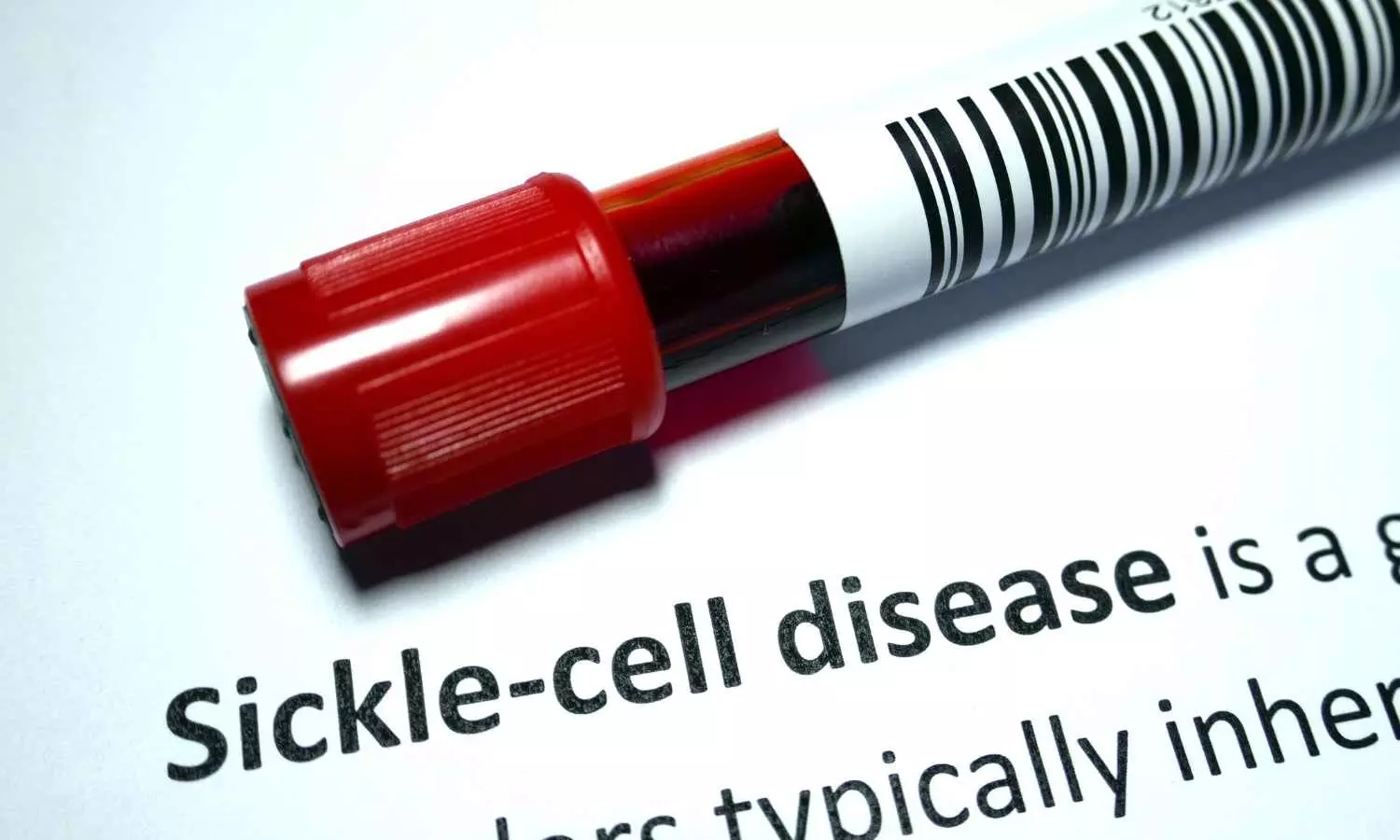 Timely pain treatment linked to reduced hospitalizations for children with sickle cell disease: Study