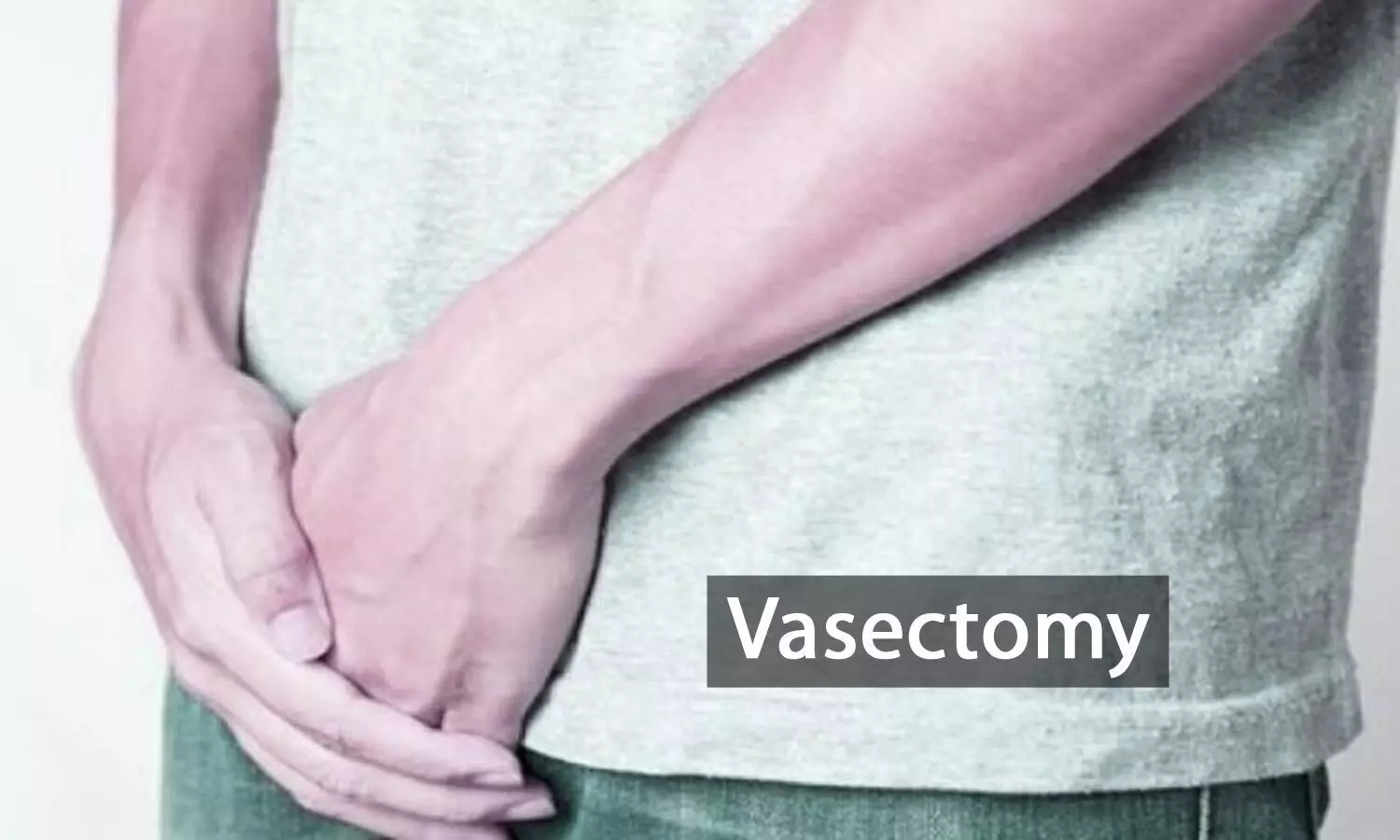 Vasectomy More Cost-Effective Than Salpingectomy for Permanent Contraception, Reveals Research