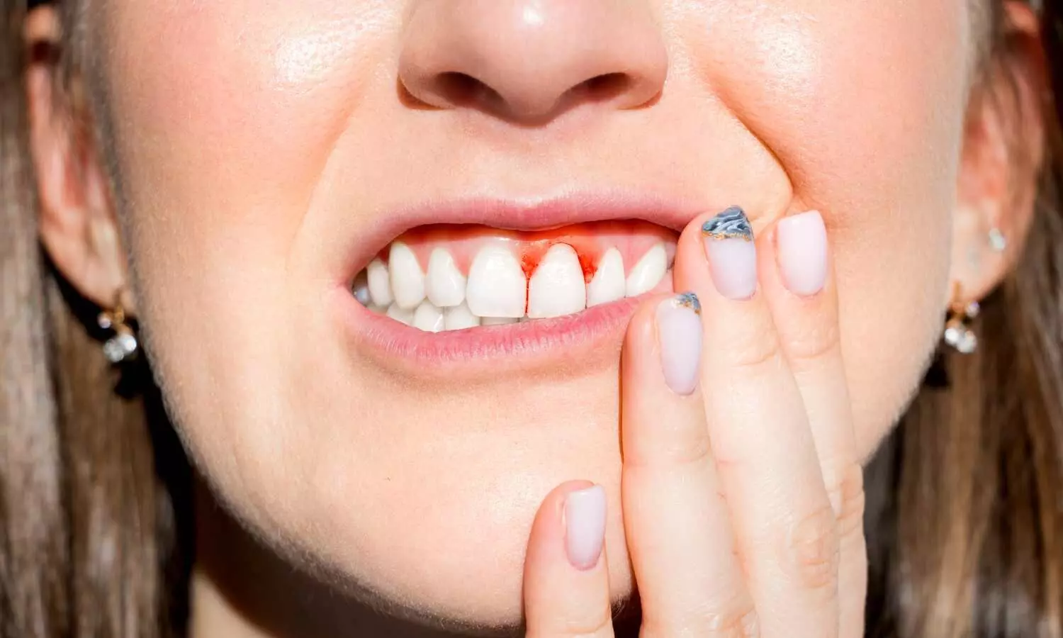 Mediterranean diet could reduce gum disease, reveals study