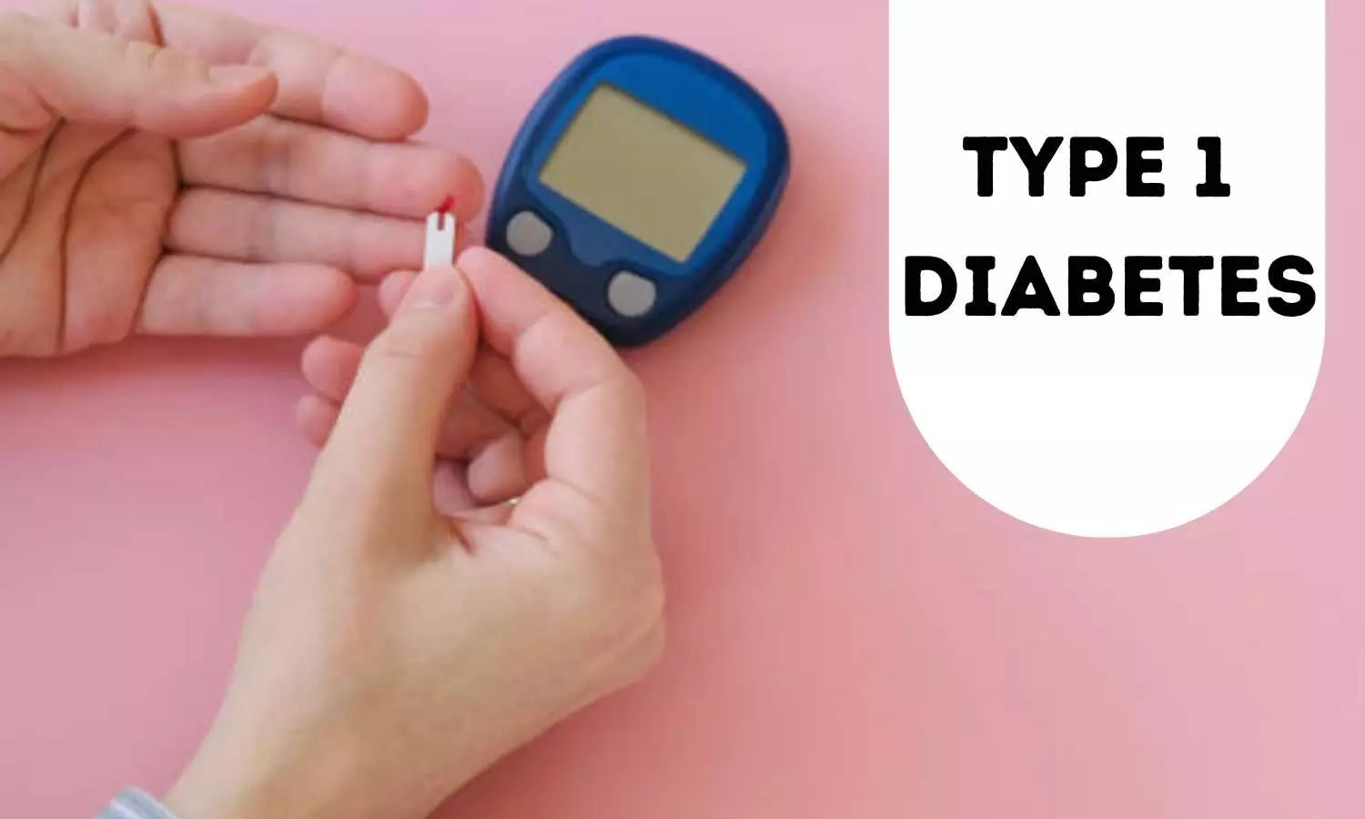 Study reports potential effects of verapamil in slowing progression of type 1 diabetes