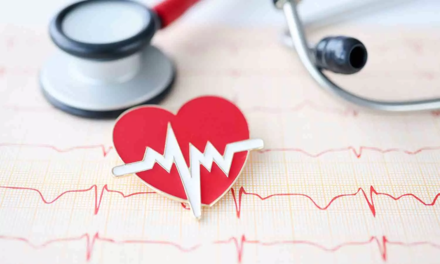Radiation therapy shows promise for patients with severe heart rhythm disorder: Study