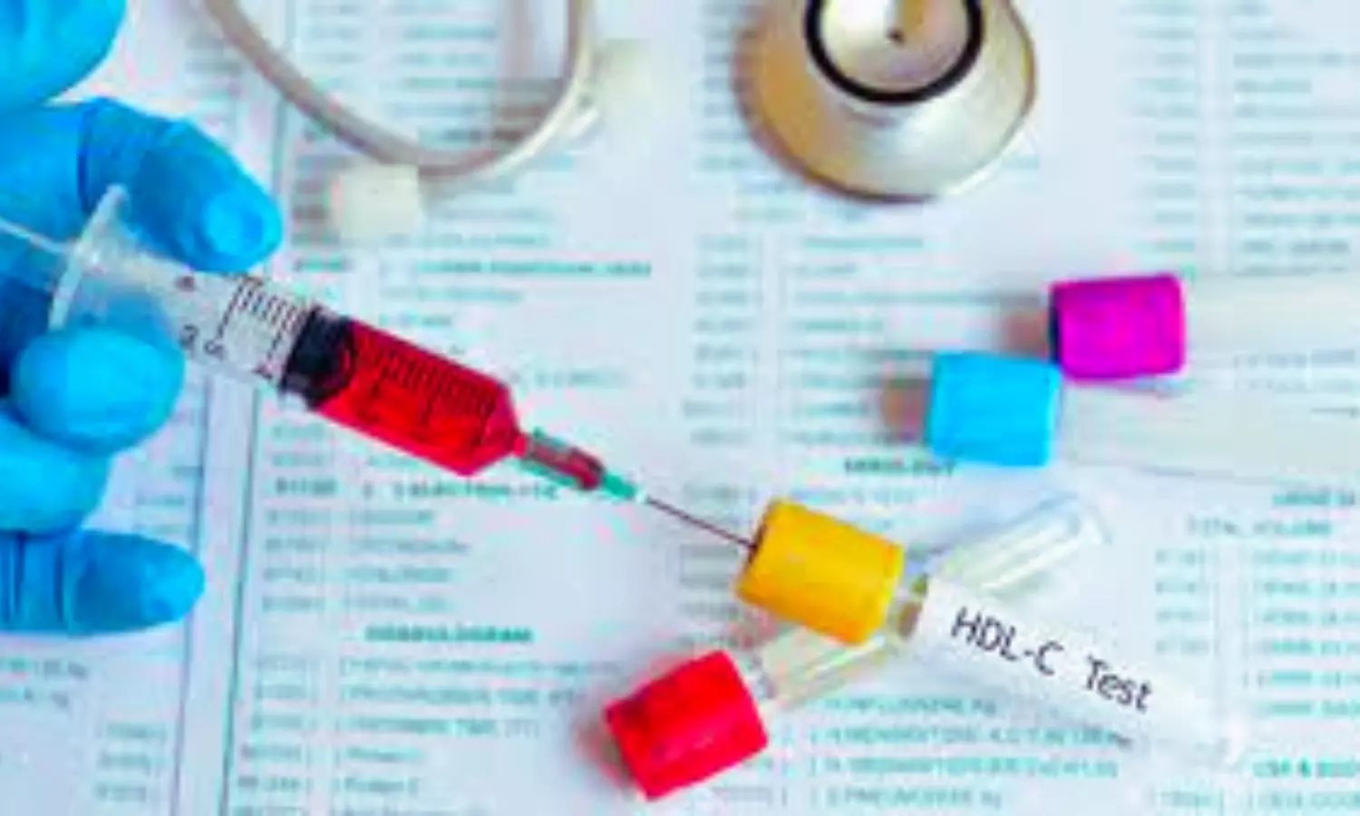 Higher non-HDL to HDL cholesterol ratio Linked to Increased Psoriasis Risk: Study