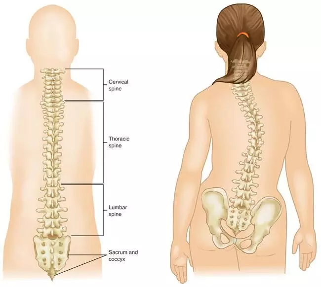 3D-printed drill guides offer superior pedicle screw placement accuracy in congenital scoliosis surgery: study
