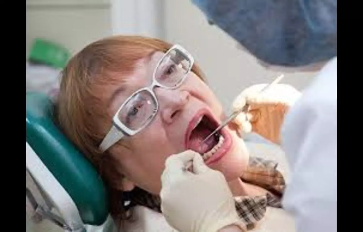 Chronic Periodontal Inflammation Linked to Increased Breast Cancer Risk: Study