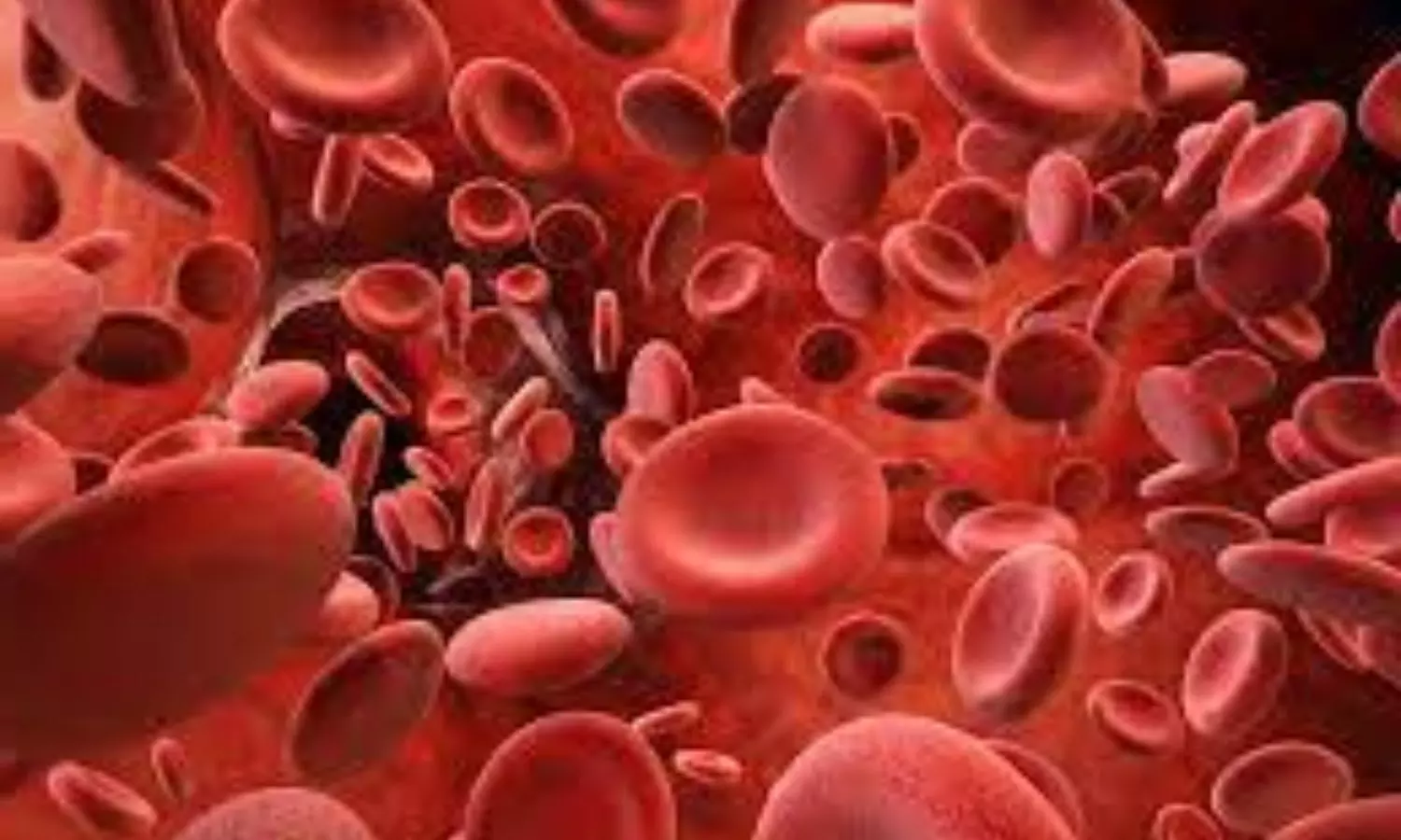 Marstacimab Shows Promising Efficacy in Hemophilia Management: Study