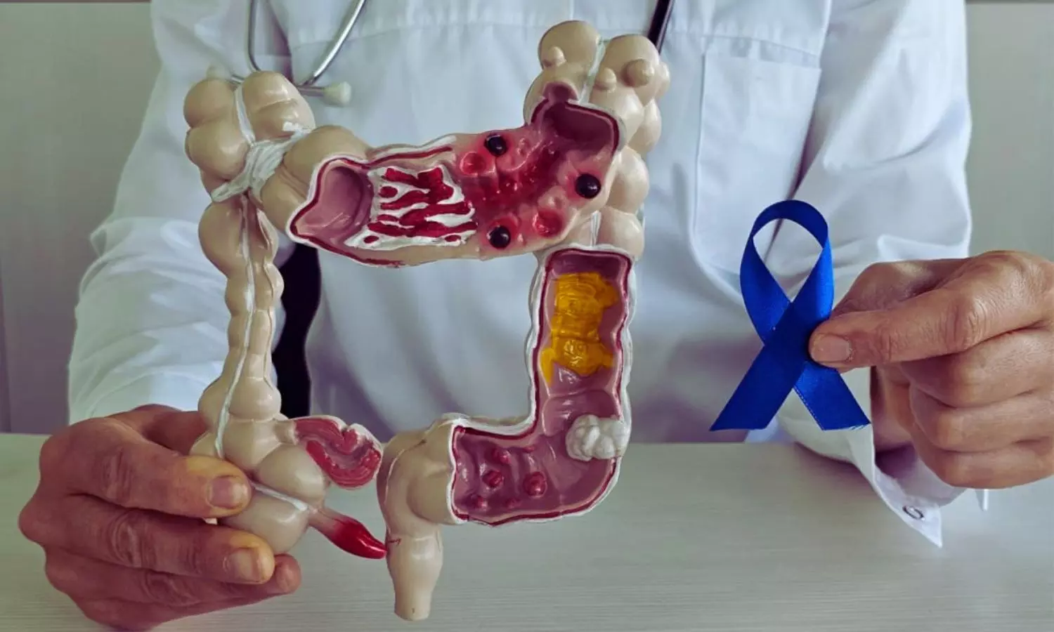 PET/MRI Outperforms Standard Imaging in Rectal Cancer Staging, Study Shows