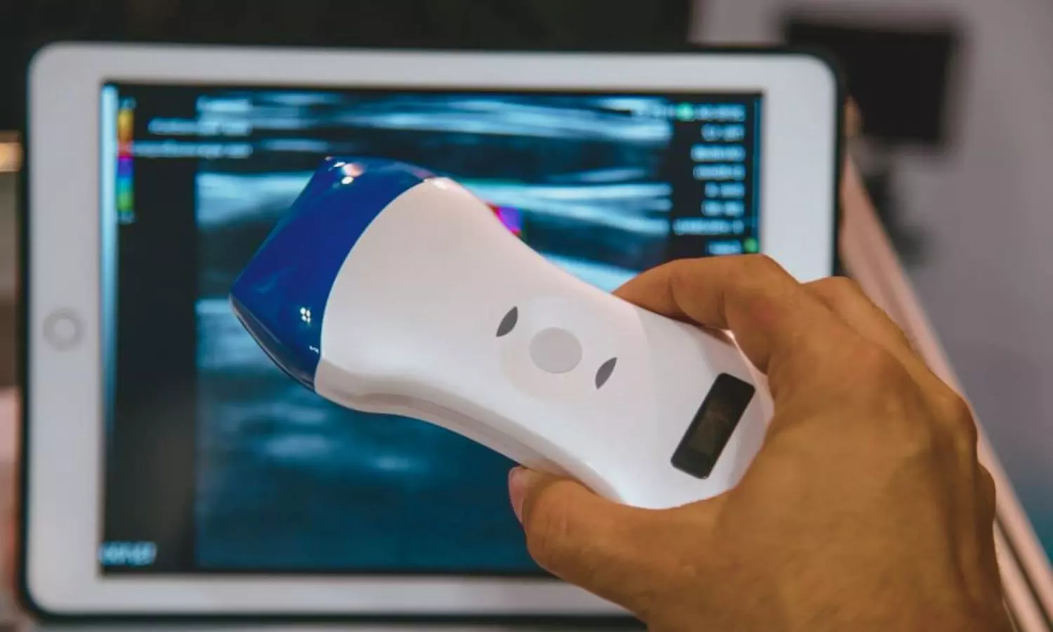 New Review Calls for 3-Lead ECG Integration in Portable Cardiac Ultrasound Devices
